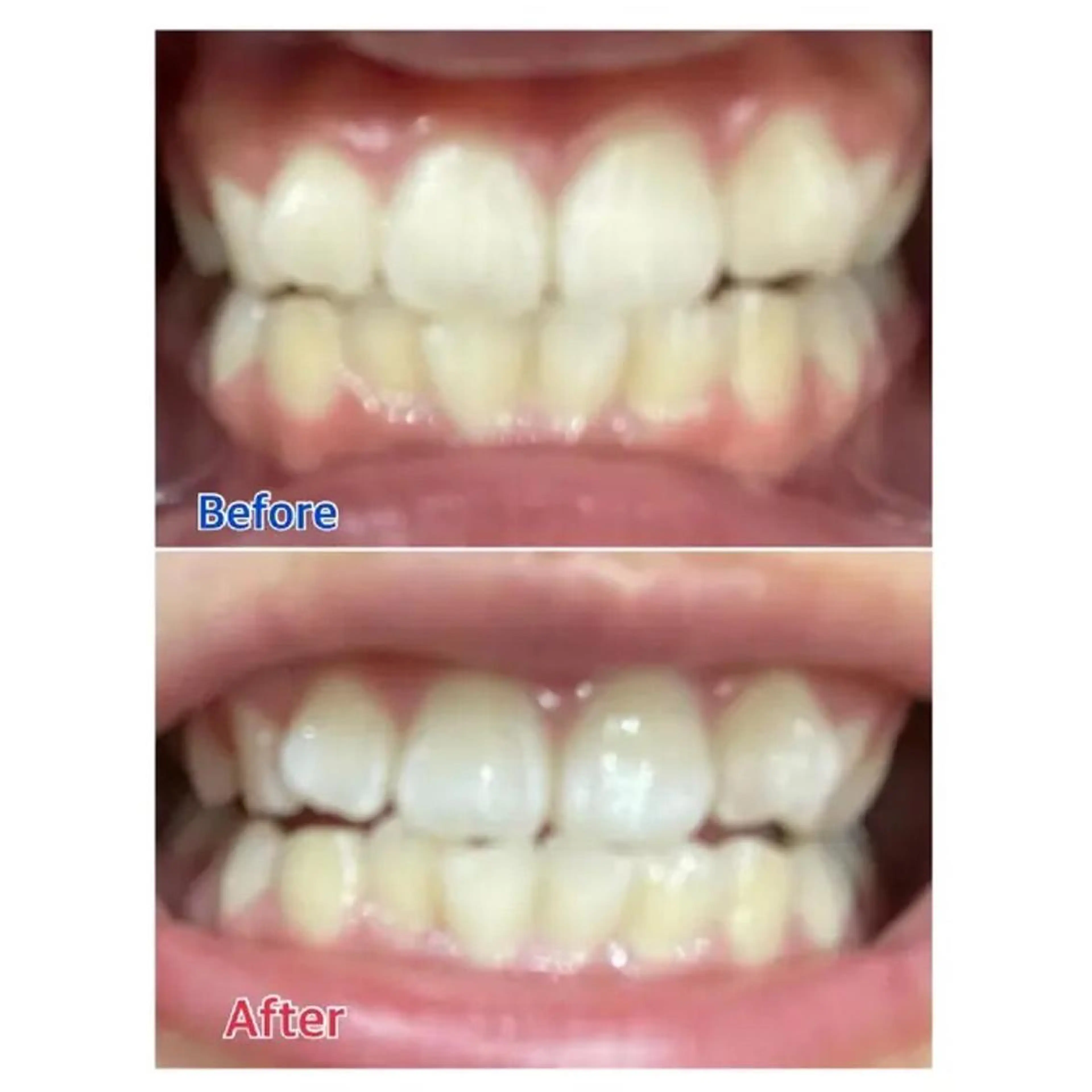 M渋谷店所属・Ｍ渋谷 ホワイトニングのその他イメージ