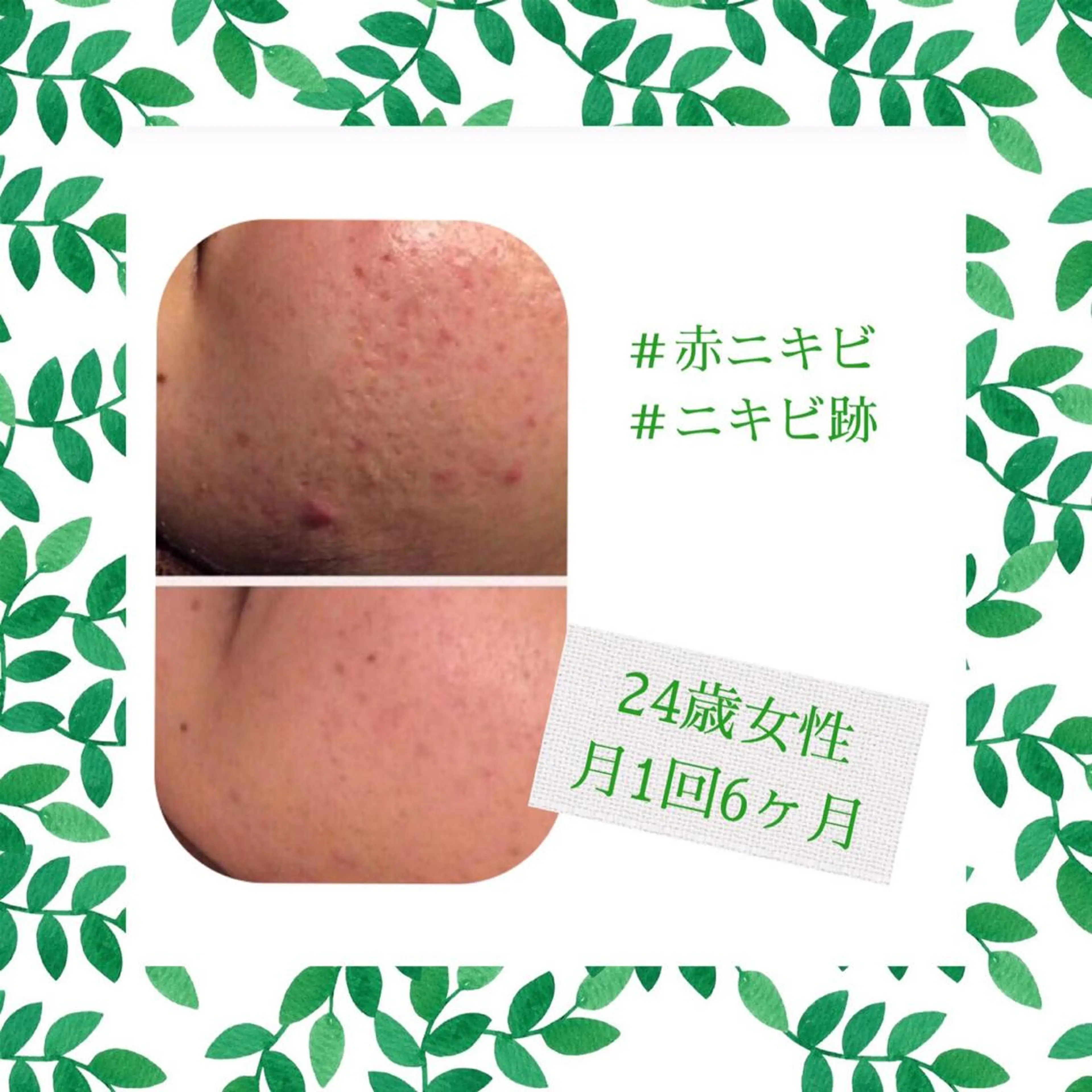 ミディアム カラー パーマ ヘアアレンジ メンズ キッズ ネイル マツエク・マツパ エステ リラク ニキビ・肌質改善専門 ♡人生が変わるサロンのエステ・リラクイメージ