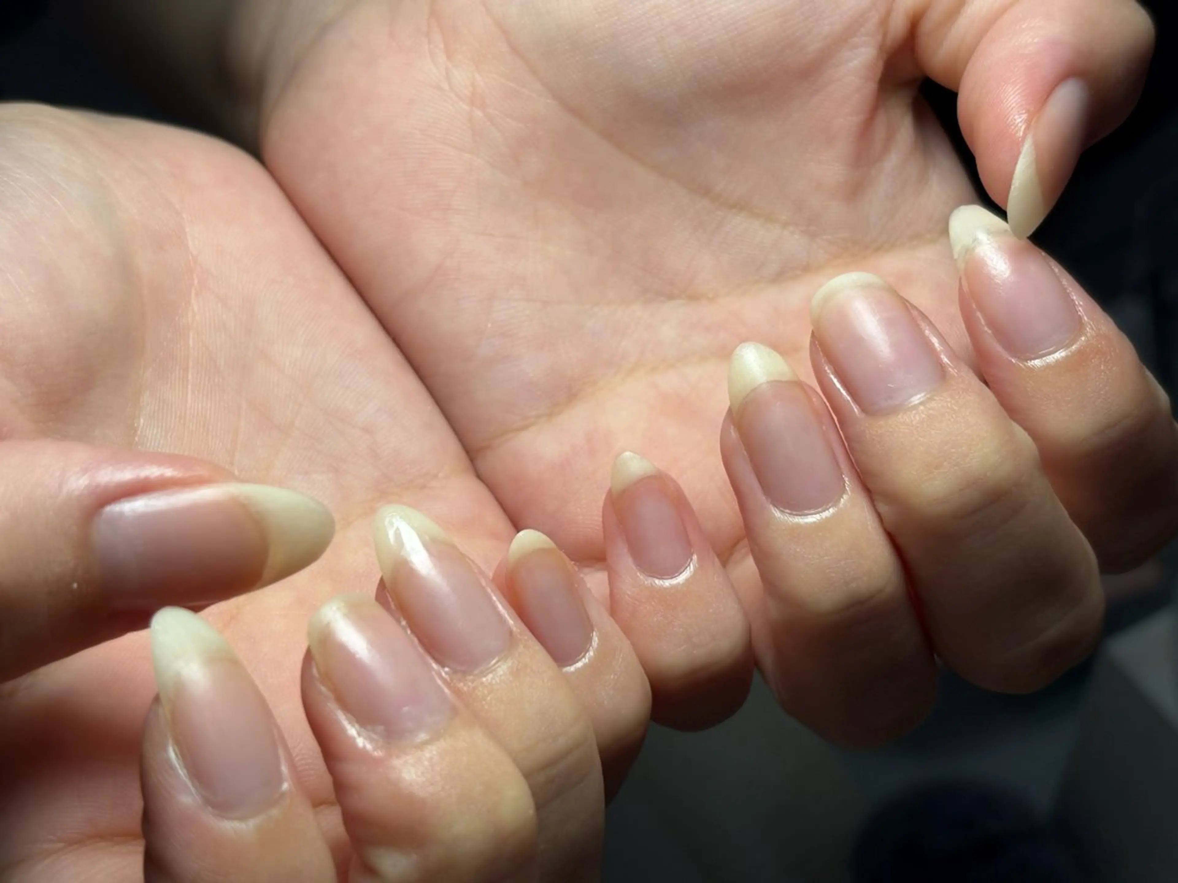 HAND◇オフのみ◇スカルプオフ(でかパーツオフ、長さだしオフ等、２本以上)の写真