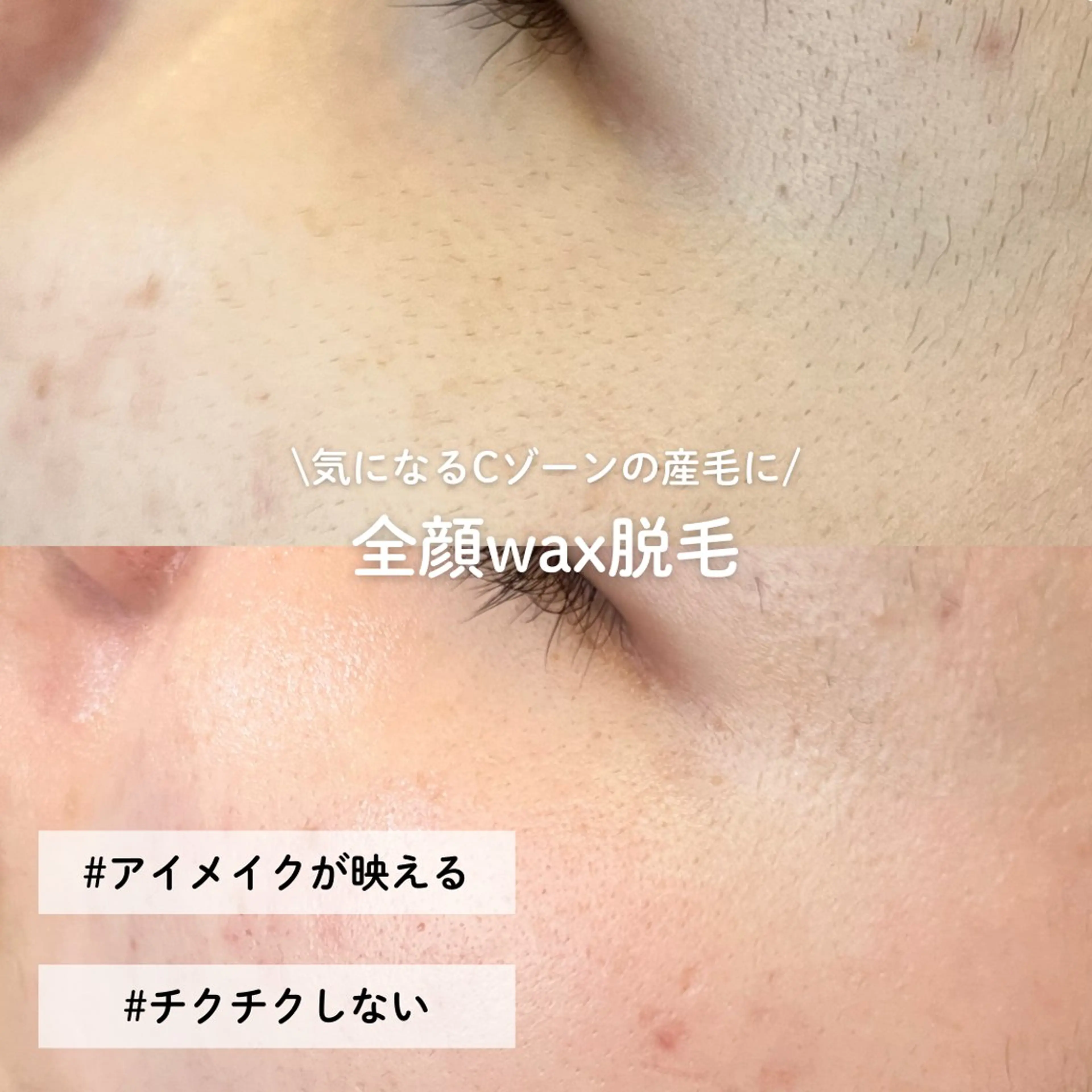 EST BEAUTY所属・顔ワックス脱毛/ ハーブピーリングのエステ・リラクイメージ