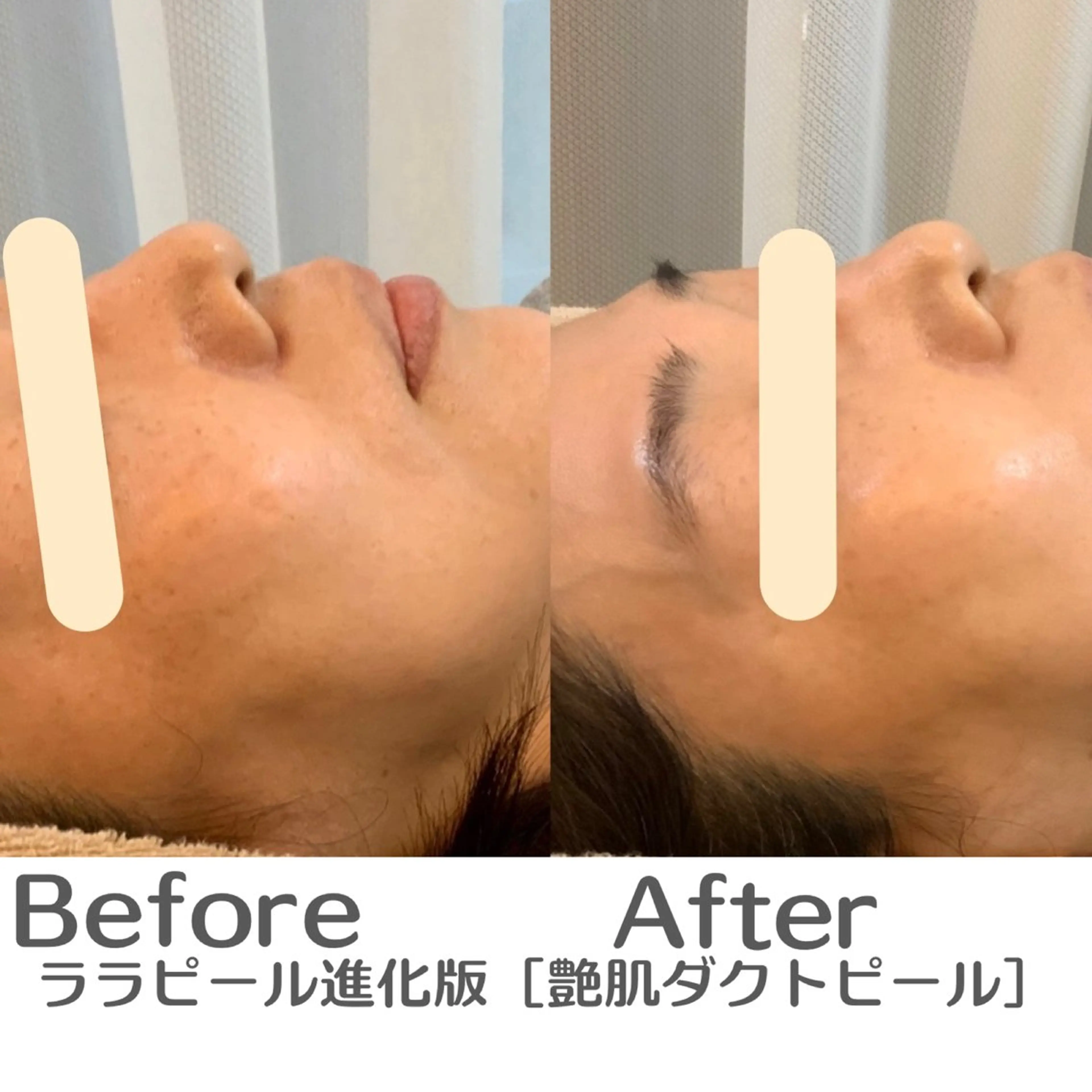 エステ 最速小顔・肌質管理 espoirマキのエステ・リラクイメージ