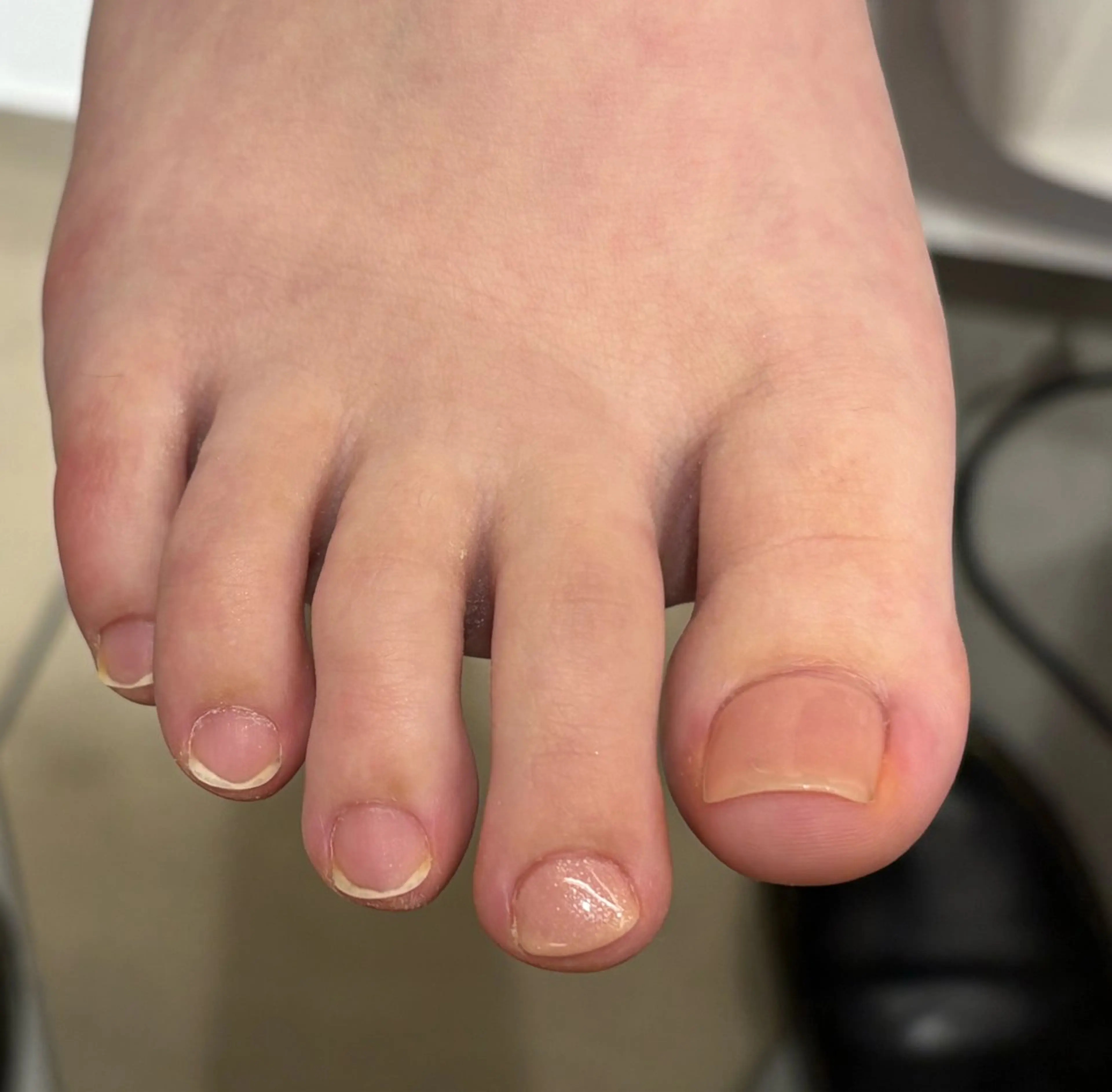 ネイル フットネイル ピンク ヤマモト セイイチロウのネイルデザイン