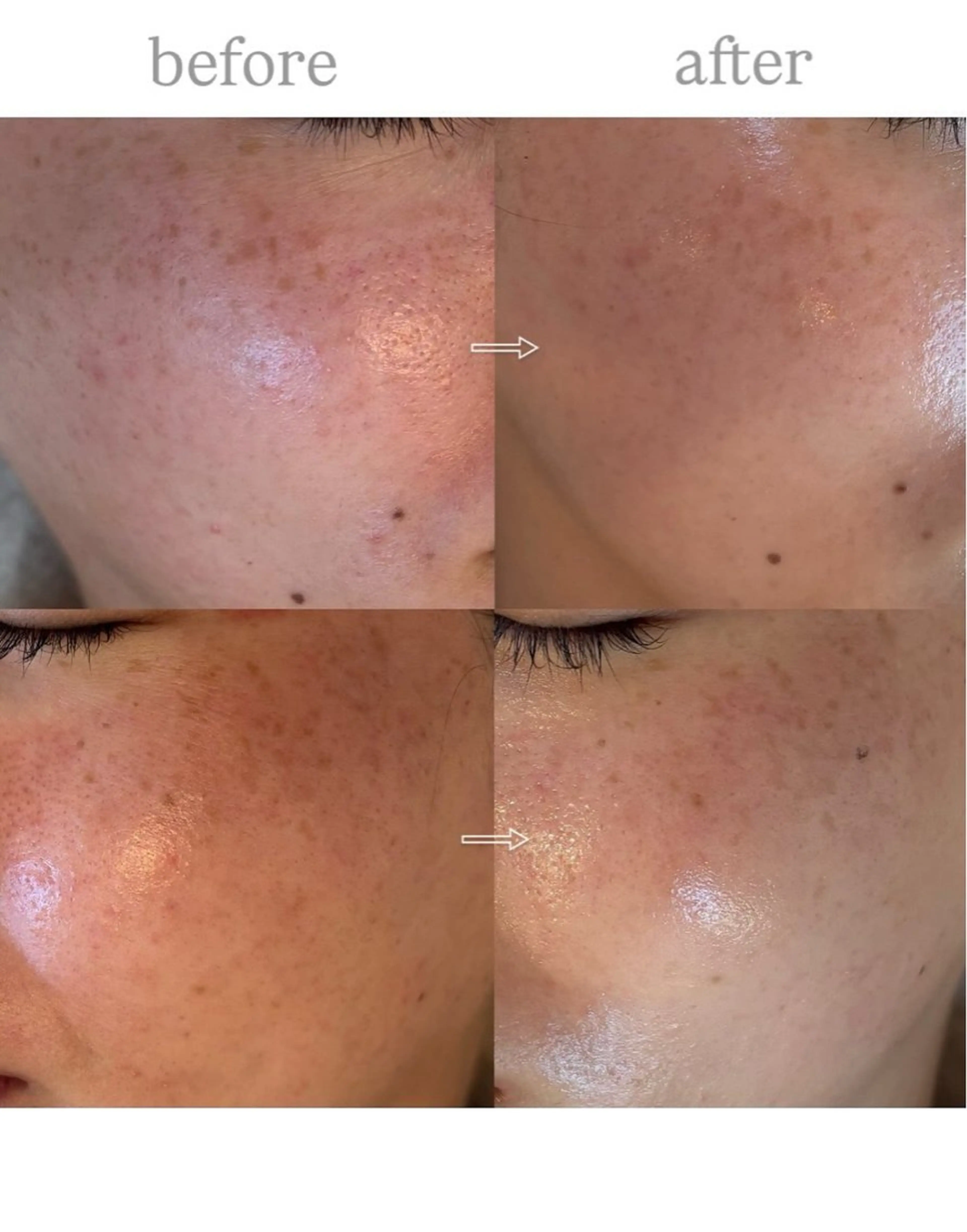 エステ anthes /MIHOのエステ・リラクイメージ