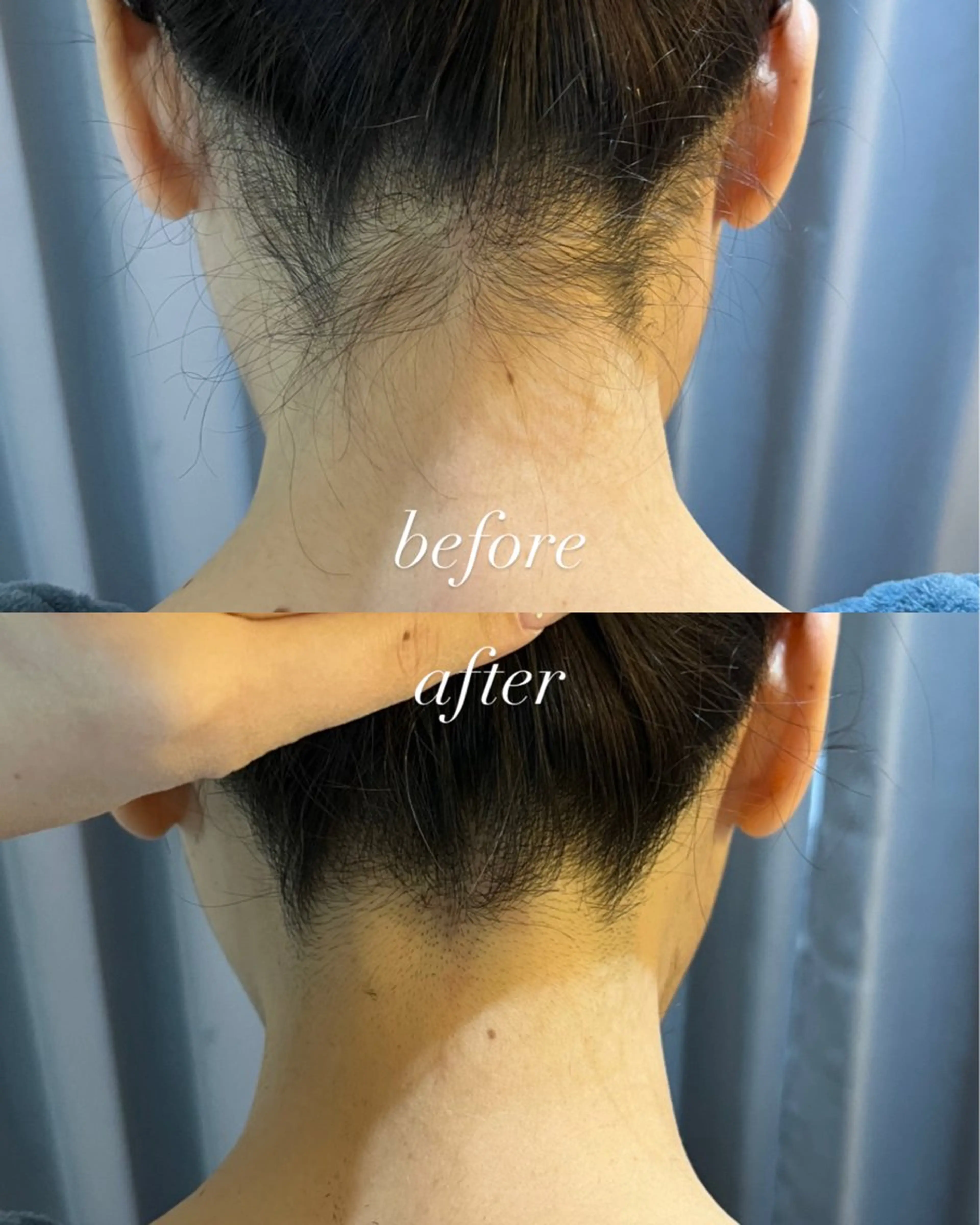 うなじ脱毛/美肌脱毛 LABELのエステ・リラクイメージ