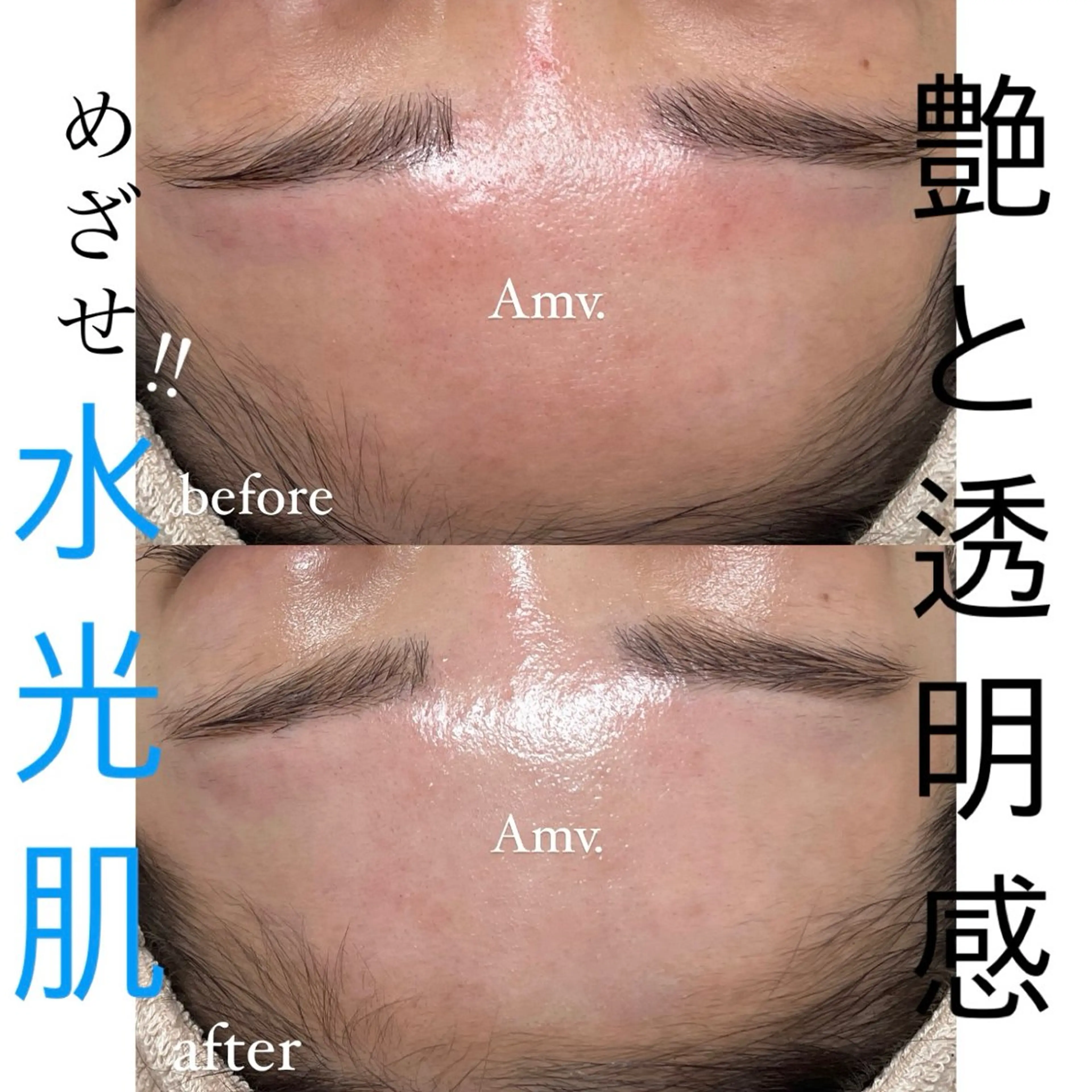 LDMエメ水肌ポレーション(潤艶光フェイシャル+ヘッドマッサージ付)60分の写真