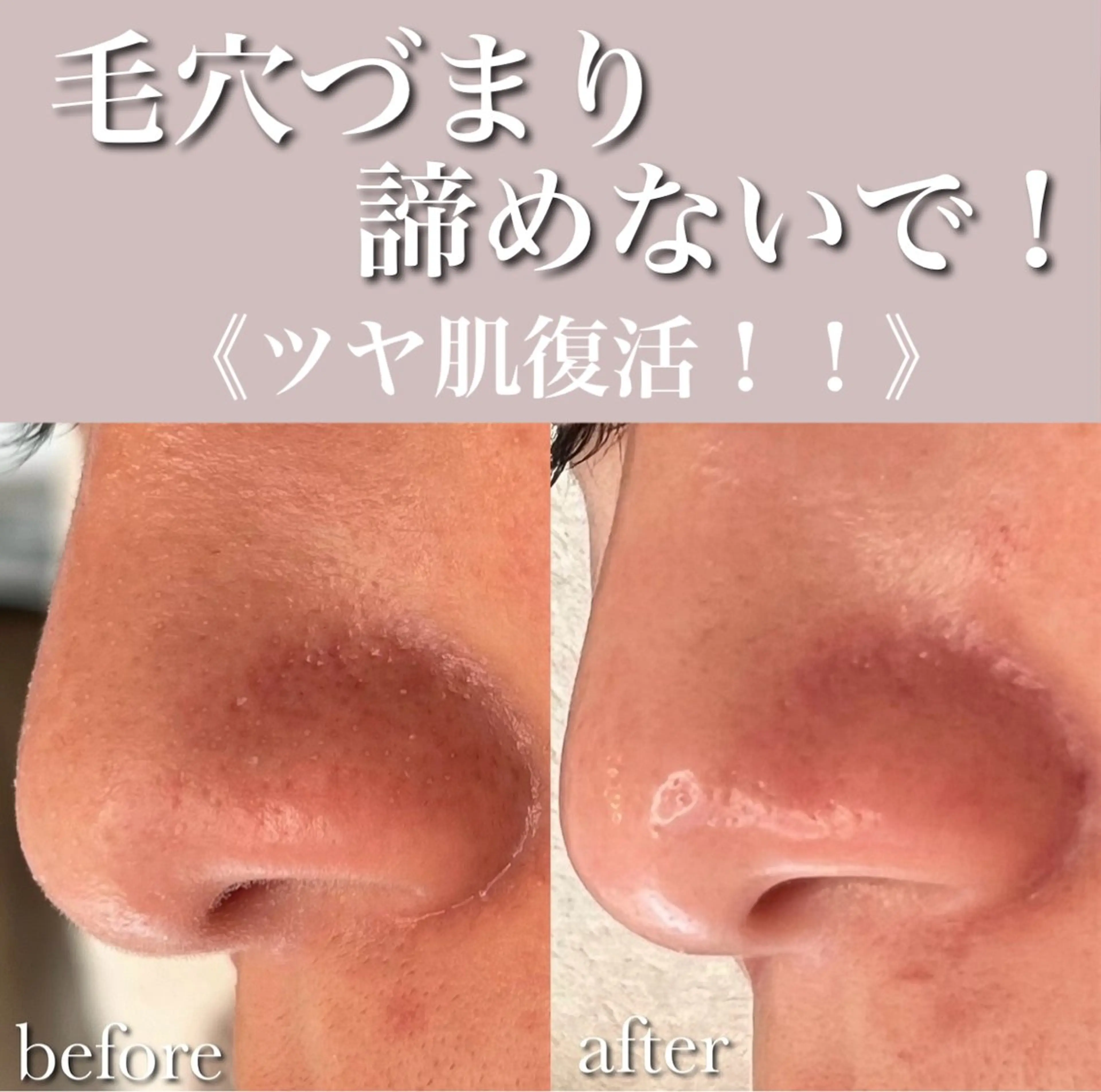 エステ Luana  アイラッシュ& フェイシャル所属・Luana eyelashのマツエク・マツパデザイン