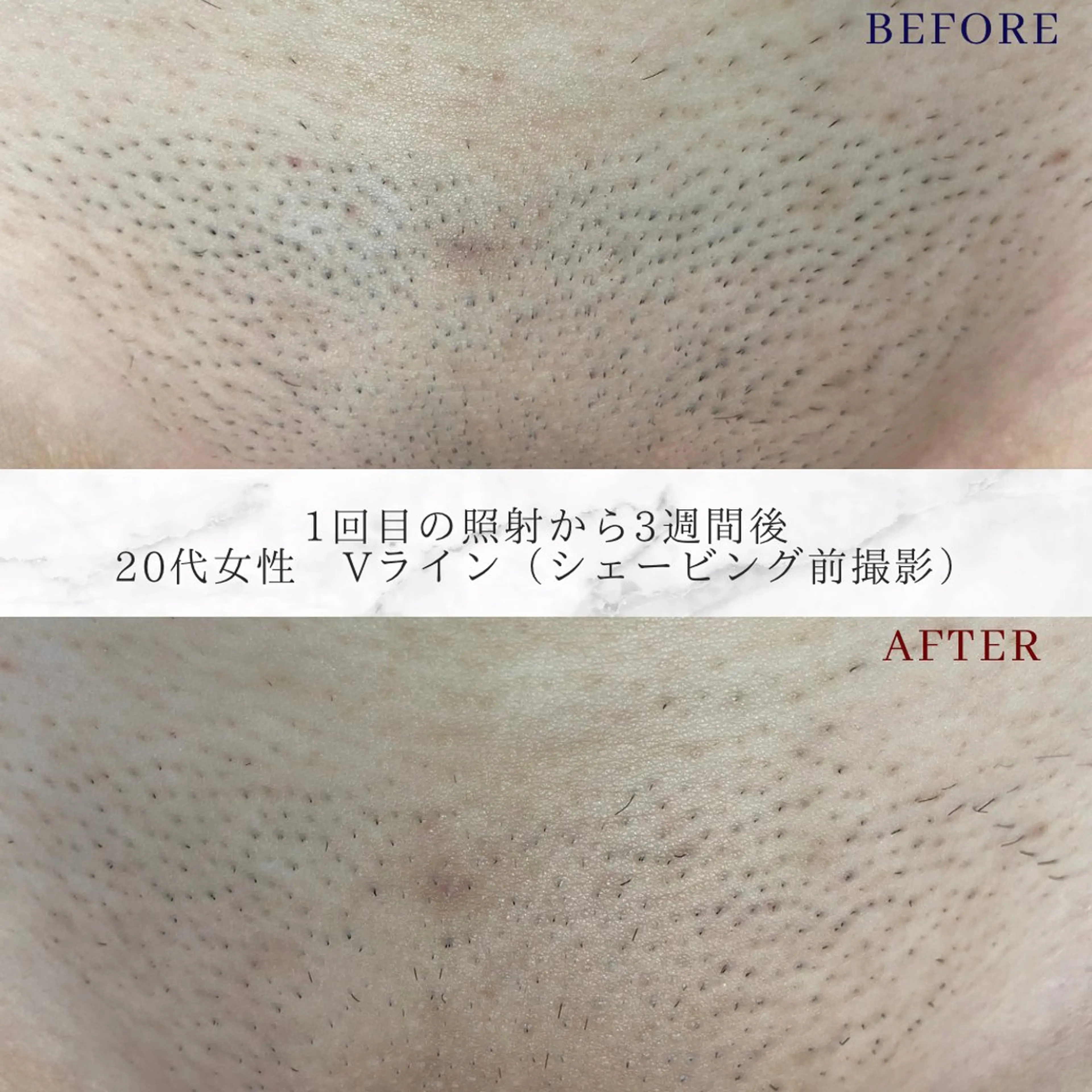 脱毛 トータルビューティー サロン　Lisseの眉毛・アイブロウイメージ