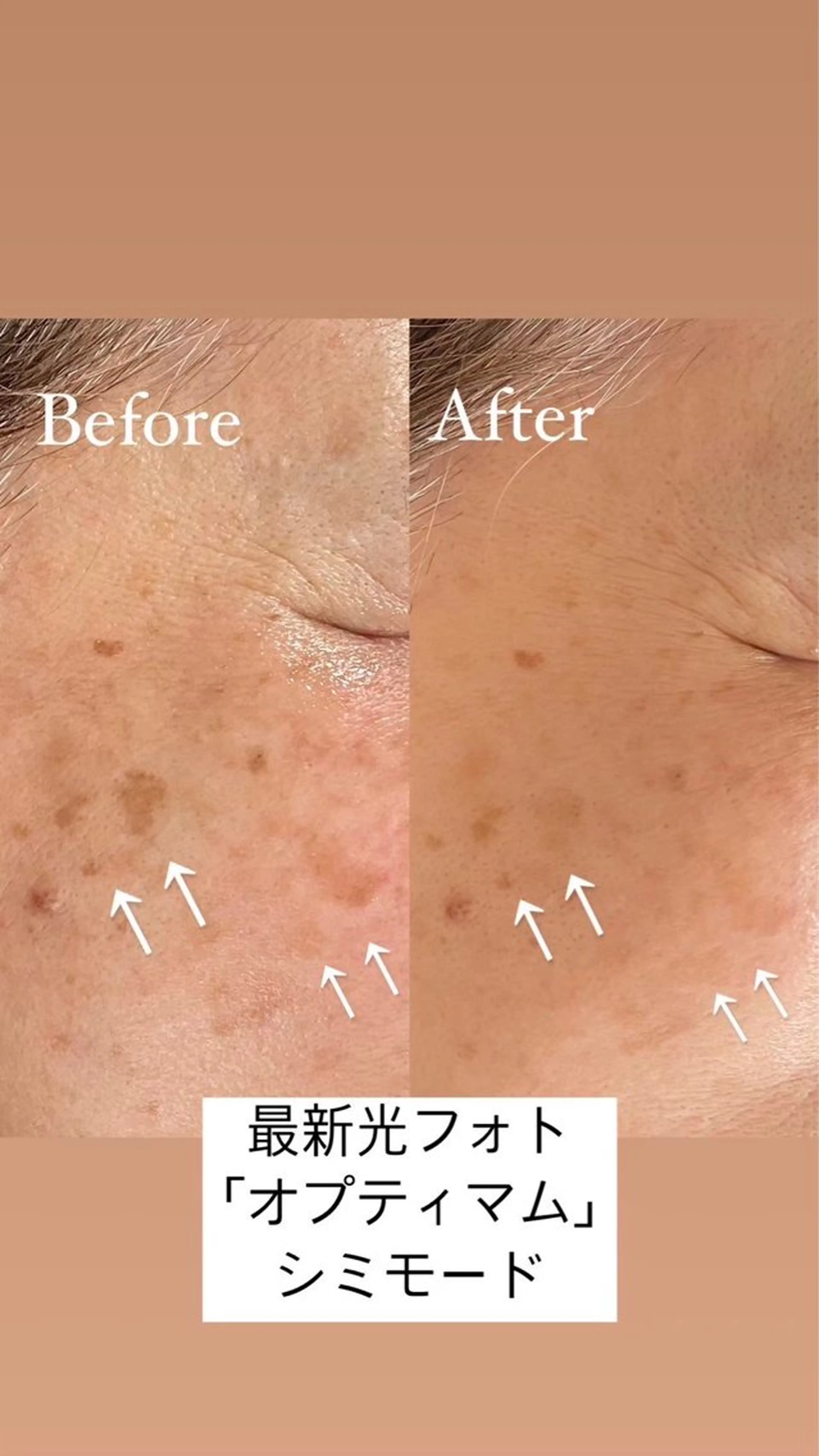 エステ スリーエスプラス内　美肌サロンEme所属・希映 -kieのエステ・リラクイメージ