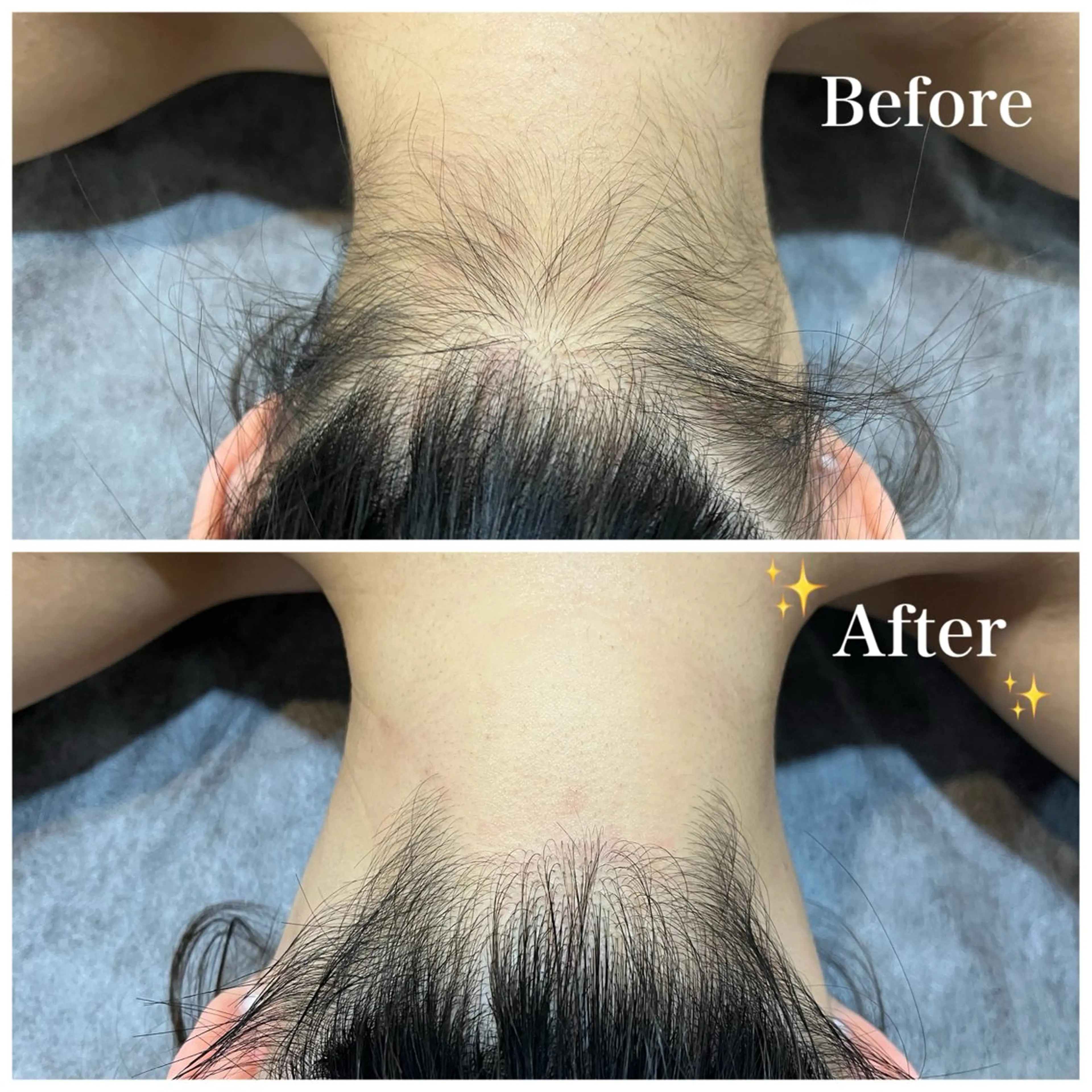 脱毛 脱毛サロン fam.豊澤柚良のエステ・リラクイメージ