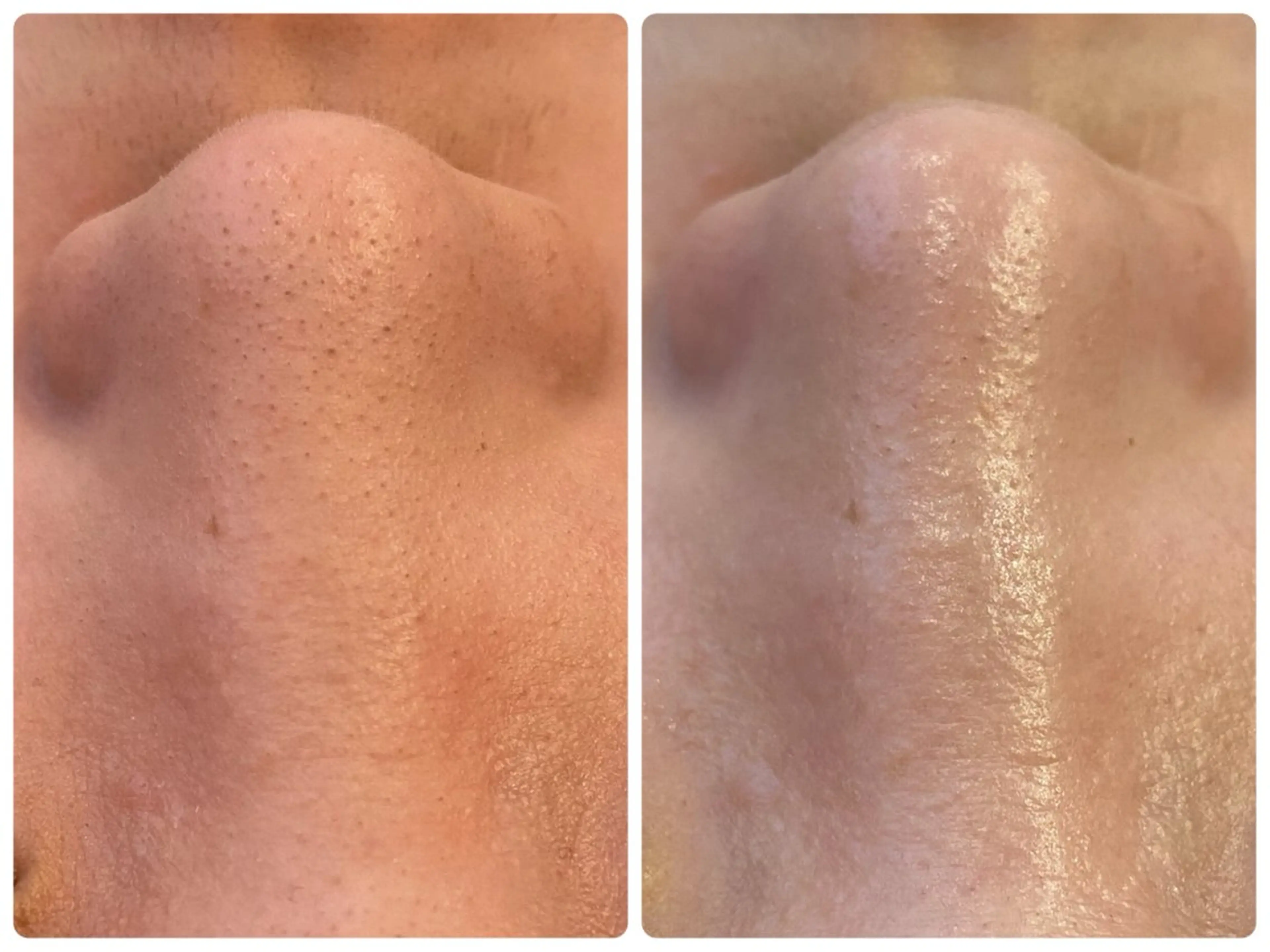 Hisui 小出のエステ・リラクイメージ