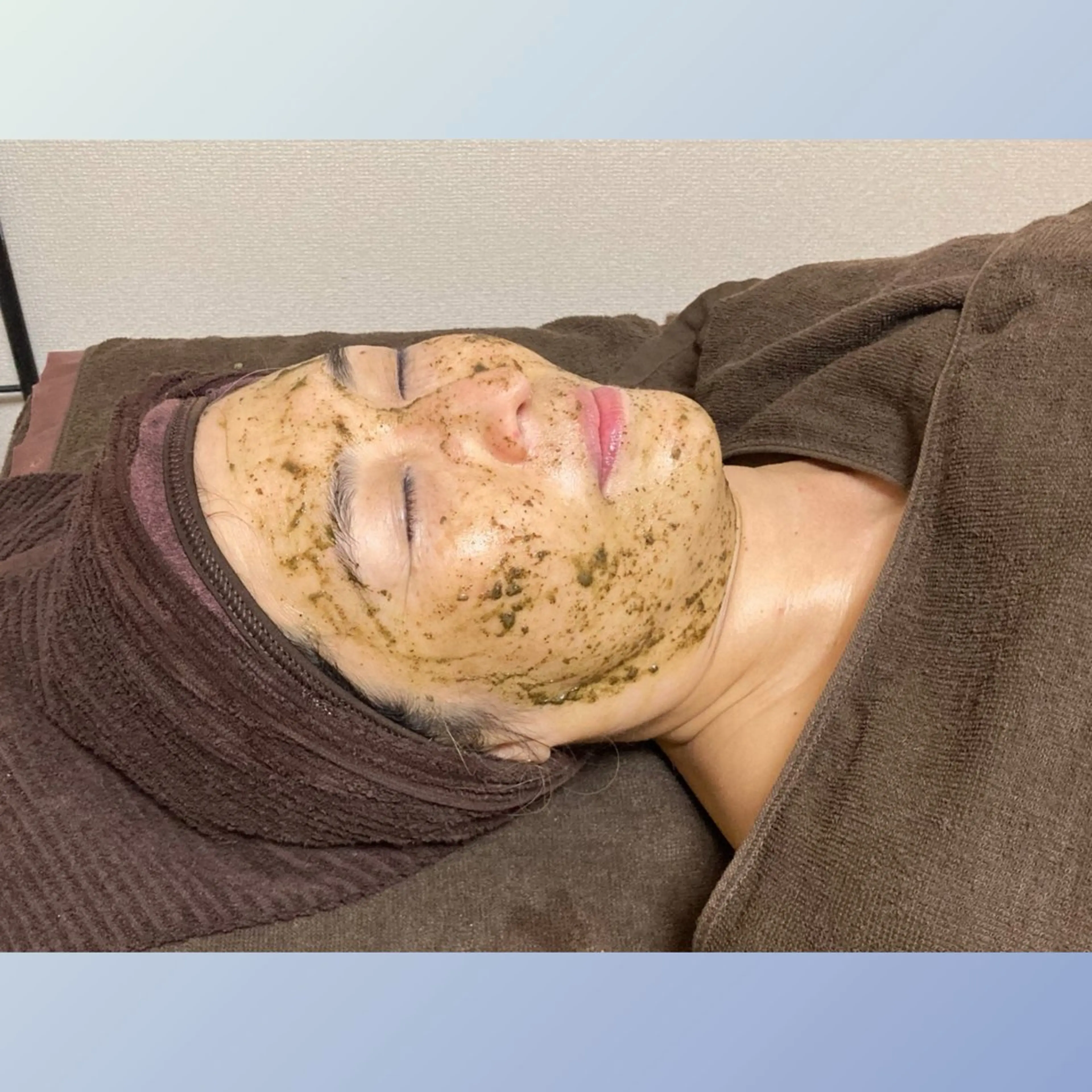 毛穴くすみ　ハーブトリートメントの写真