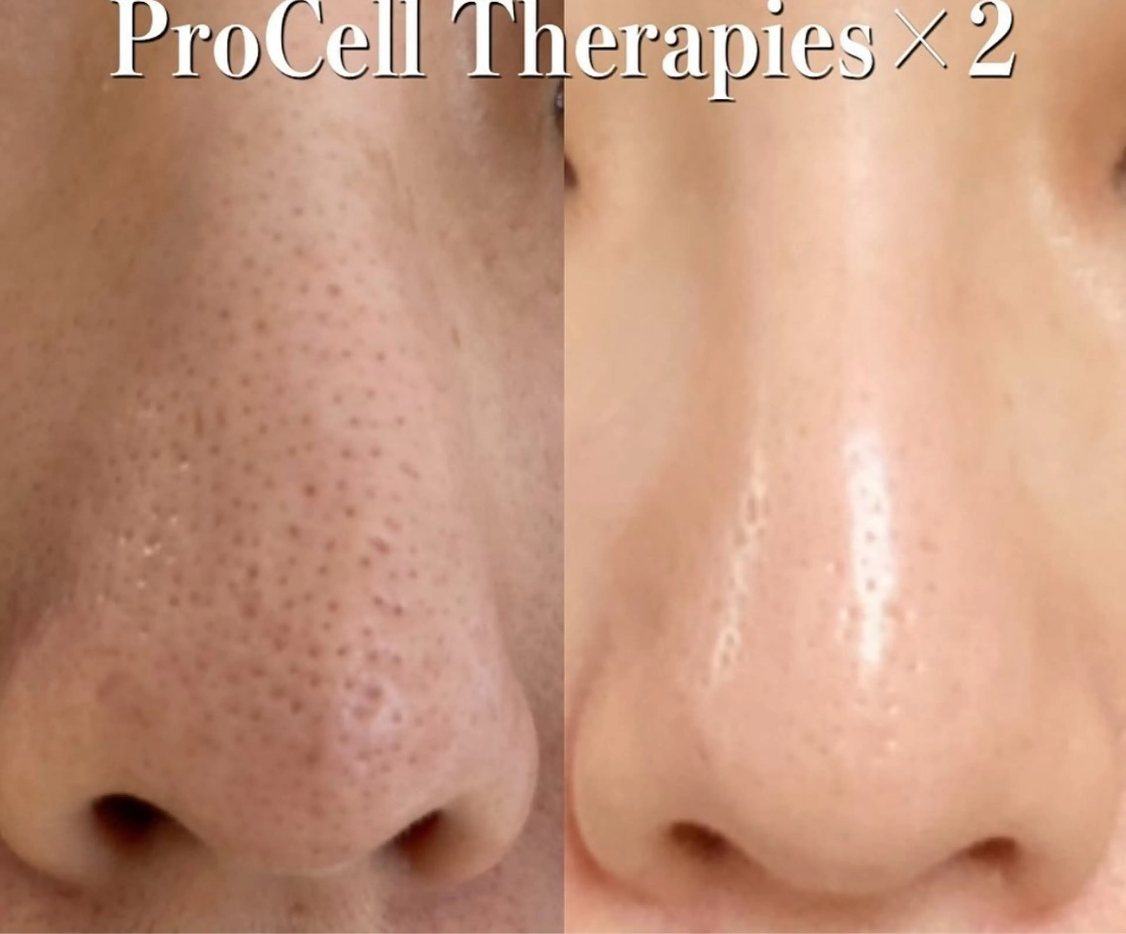 Blooming所属・LOUISE. ／肌質・頭皮のエステ・リラクイメージ