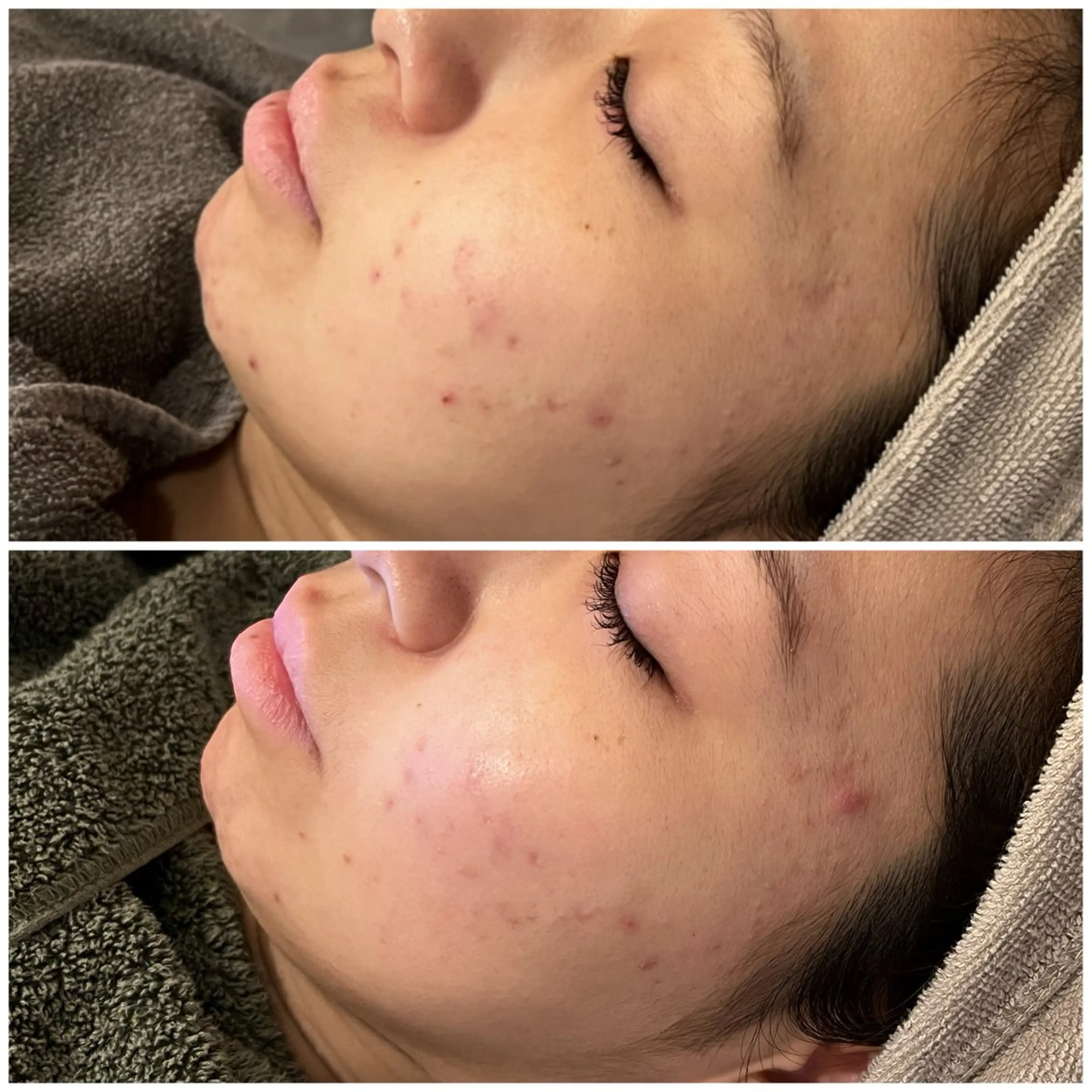 脱毛 yellow.所属・yellow💛【 脱毛&フェイシャル】のエステ・リラクイメージ