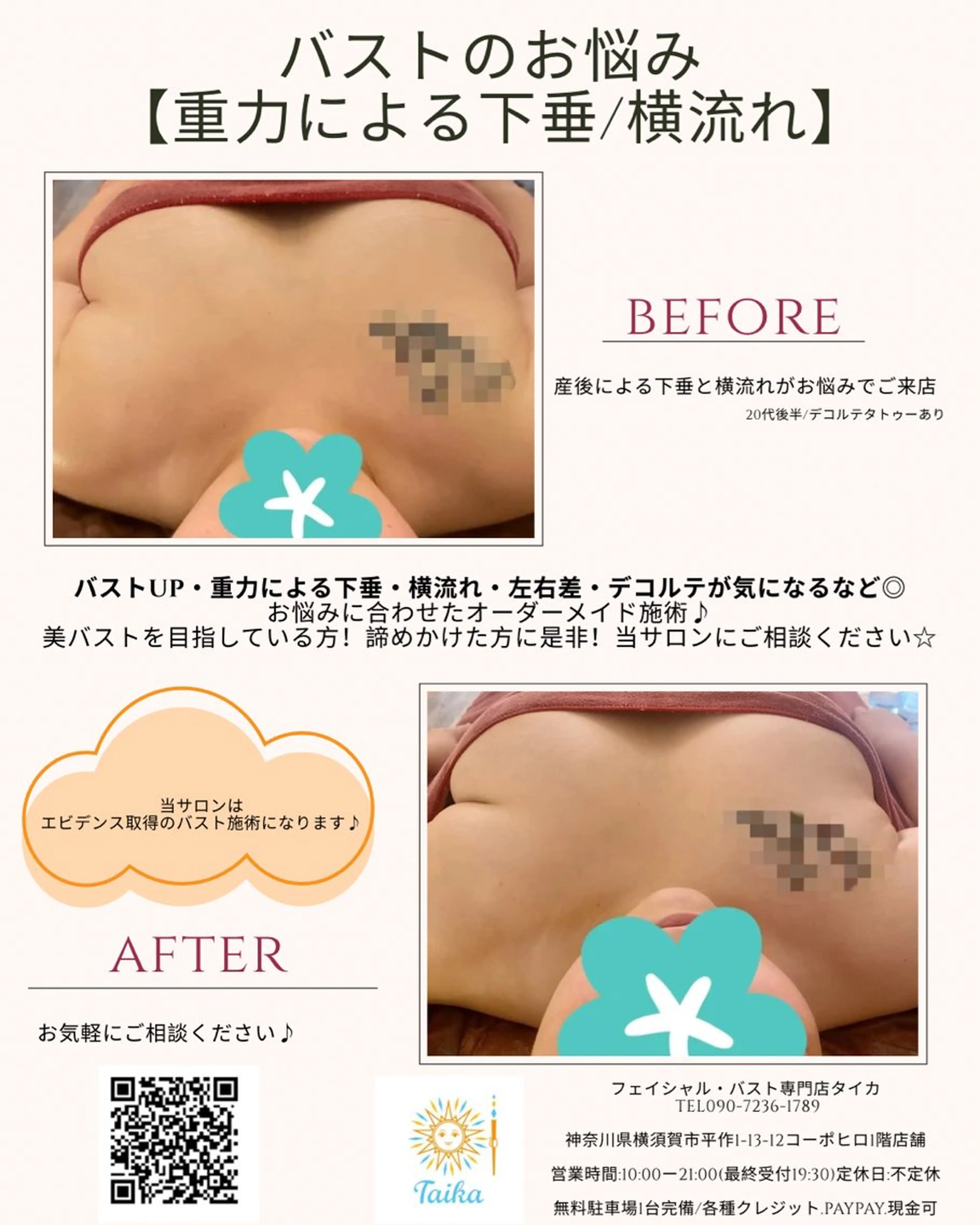 Taika(タイカ)フェイシャル/バスト専門店所属・モニター募集 女性のお悩み専門店のエステ・リラクイメージ