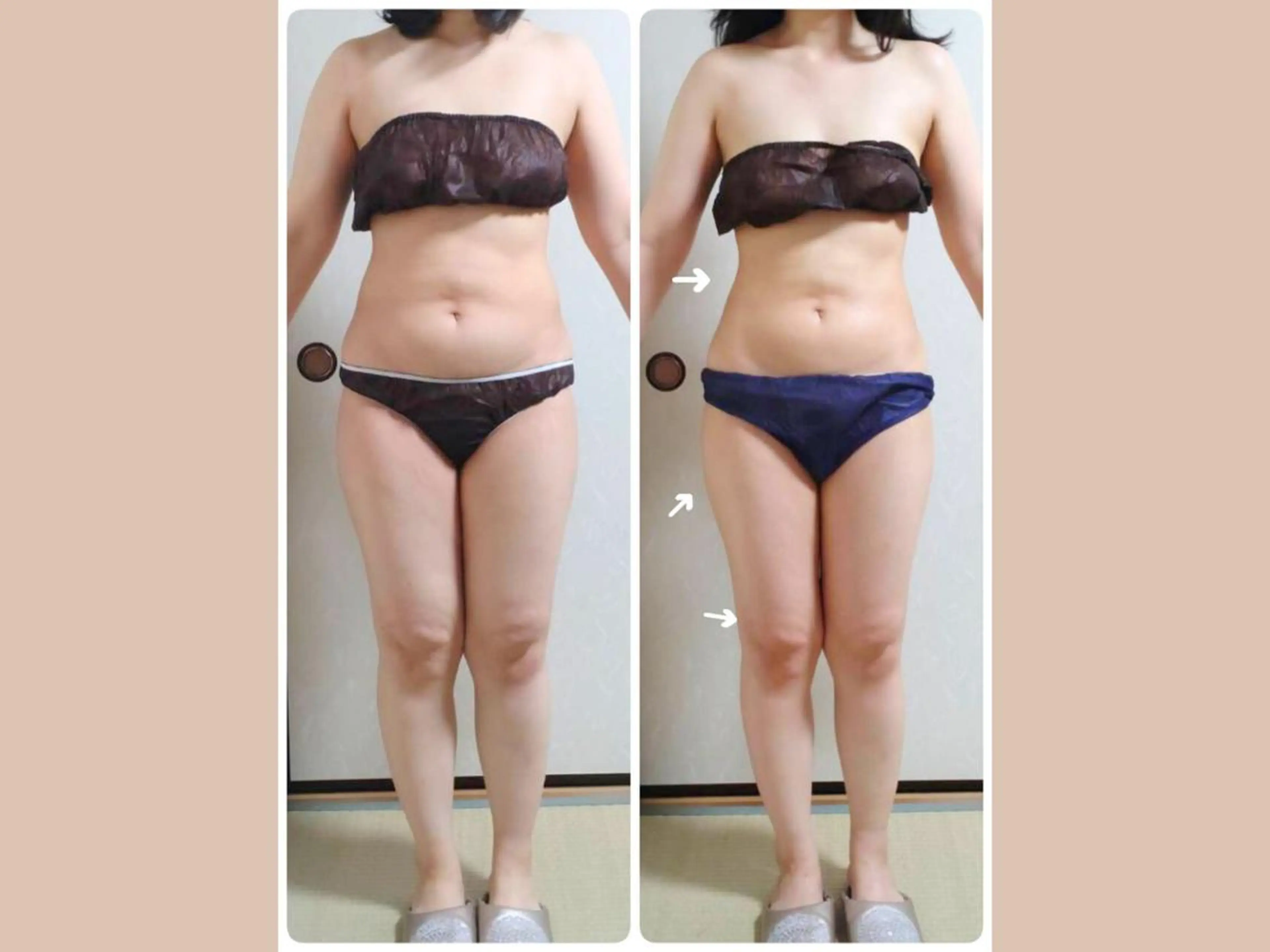 その他 痩身&小顔矯正専門店 Re:Livesのエステ・リラクイメージ