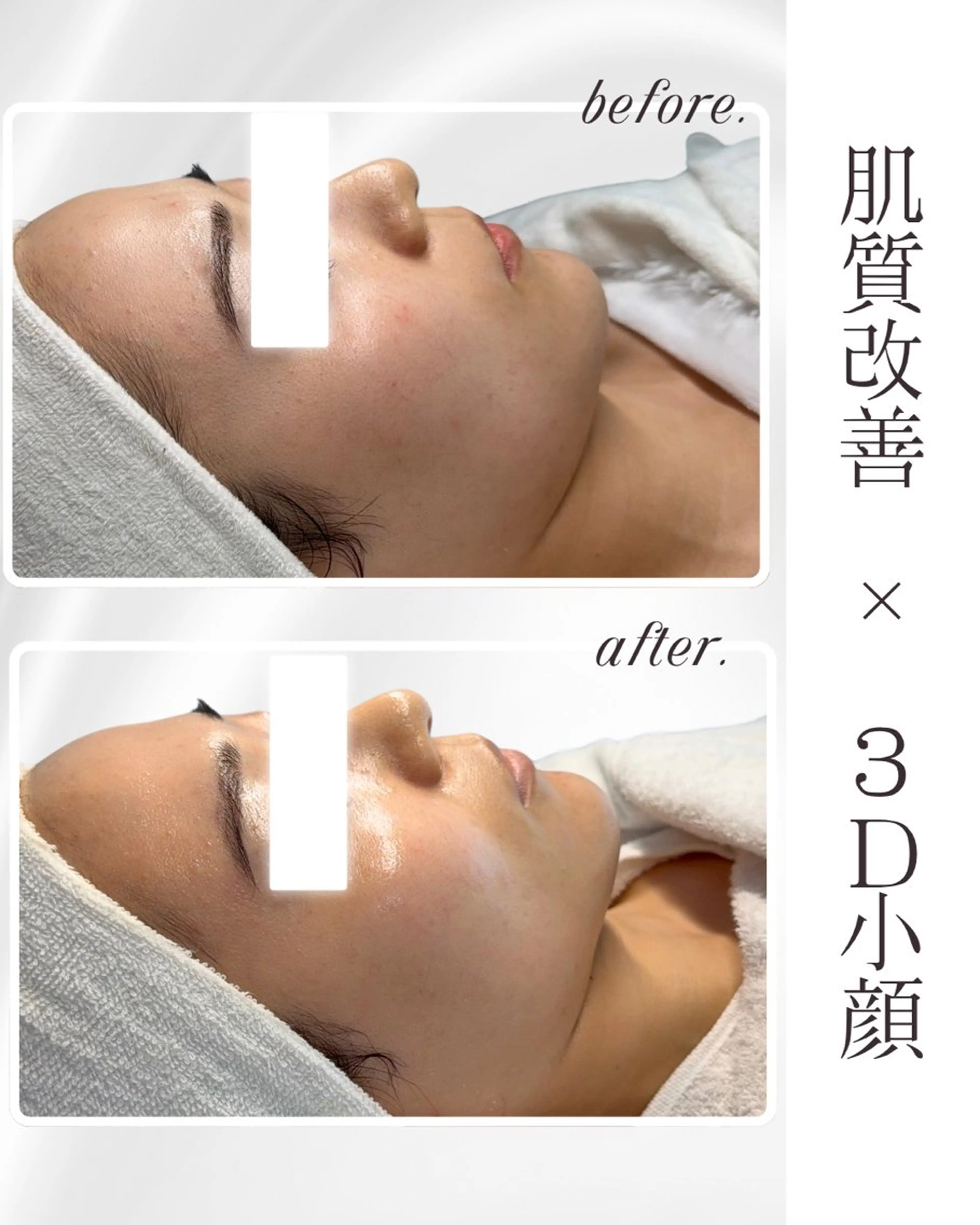 Liam《美肌管理/ 3D小顔/脂肪ケア》のエステ・リラクイメージ