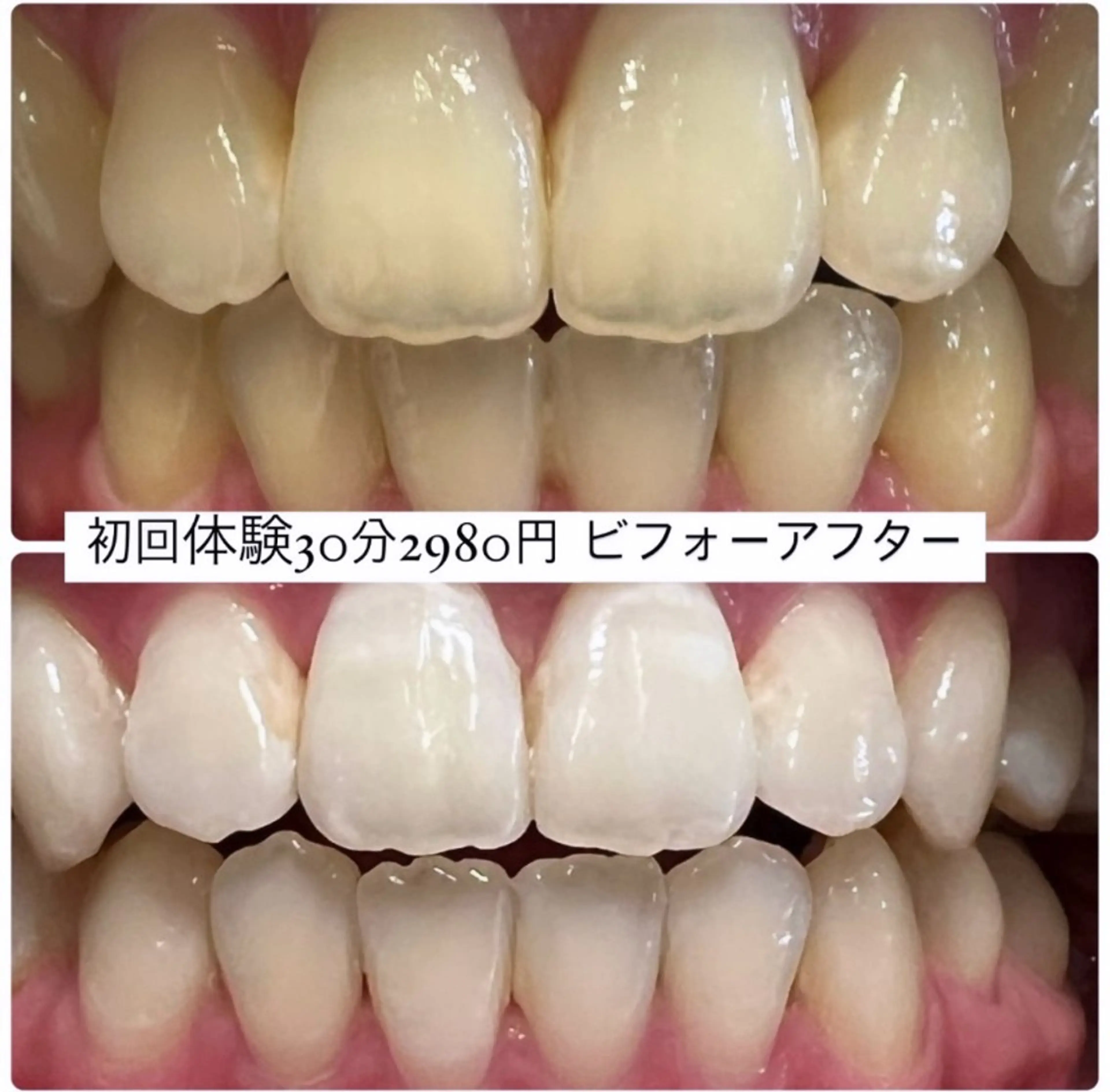 その他 PLATINUM Beauty 横浜店所属・ホワイトニングルーム 横浜店のその他イメージ