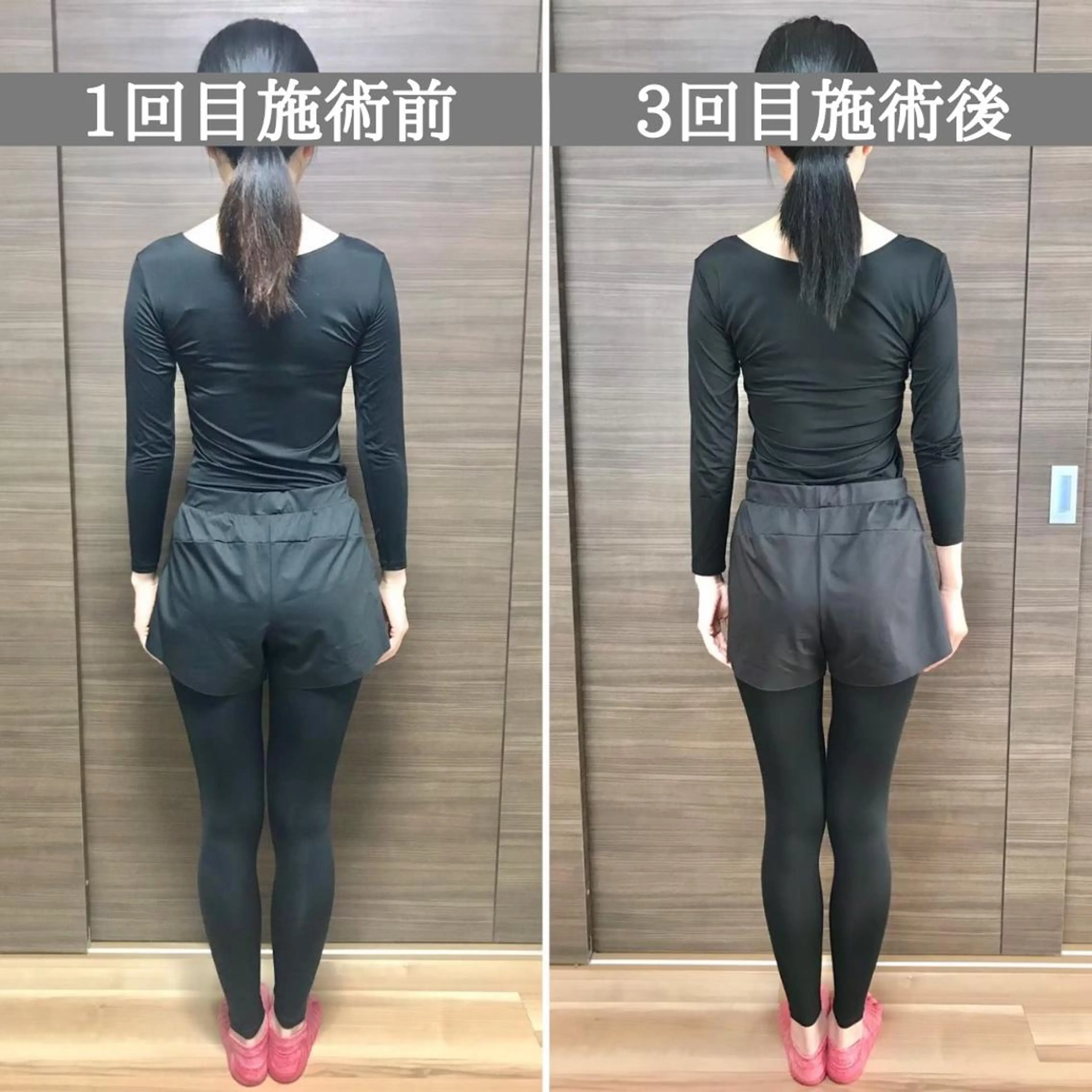 エステ リラク 美容整体サロン Chare人形町店のエステ・リラクイメージ