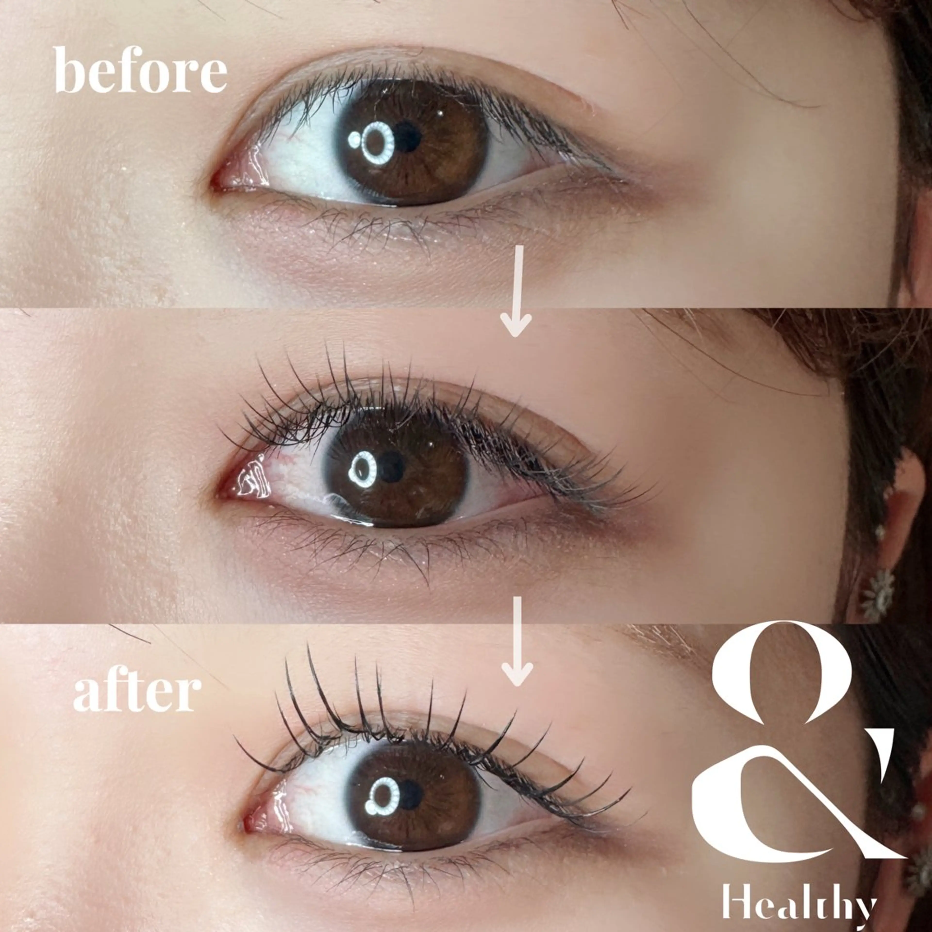 【最新技術】&healthy フラットラッシュ100本の写真