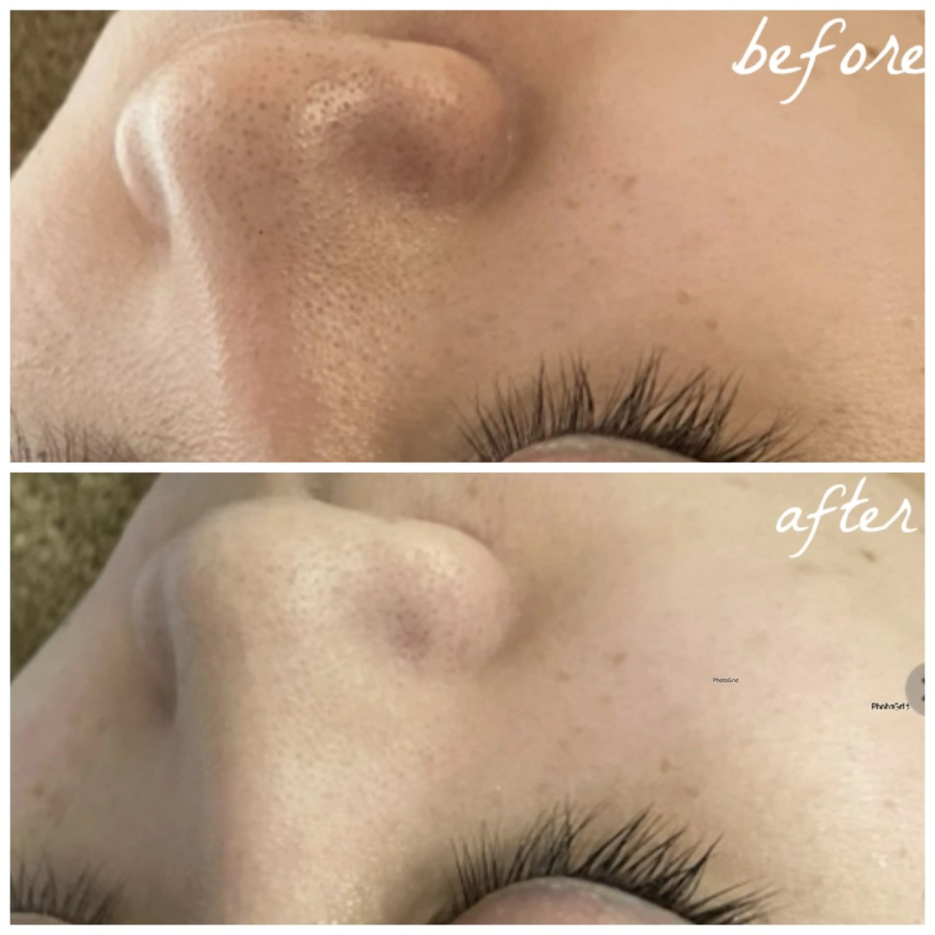 メンズ エステ メナード岐阜茜部 杉浦のエステ・リラクイメージ