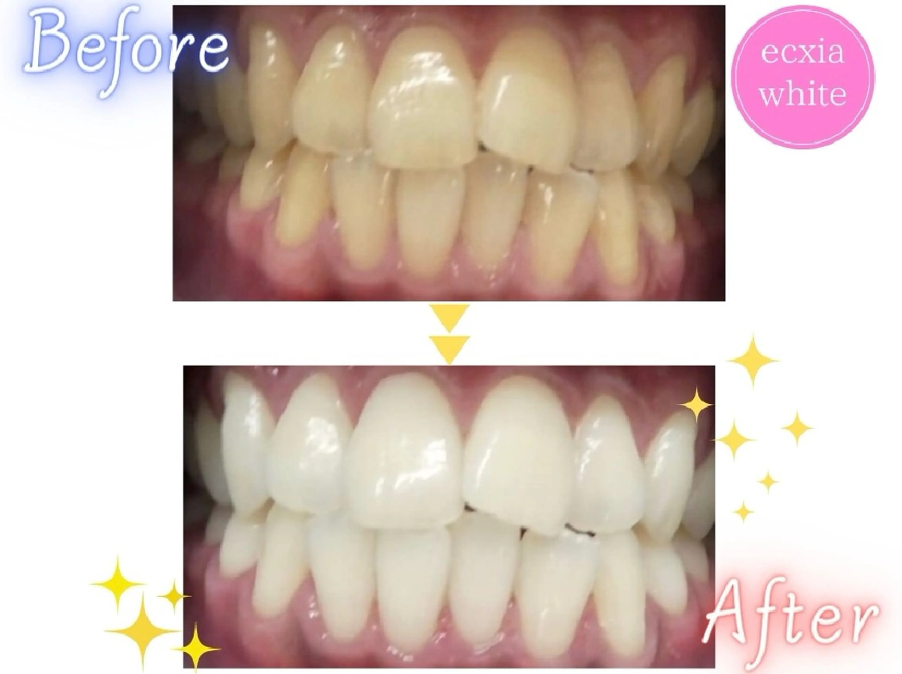 エクシアホワイト 秋田saitoのその他イメージ