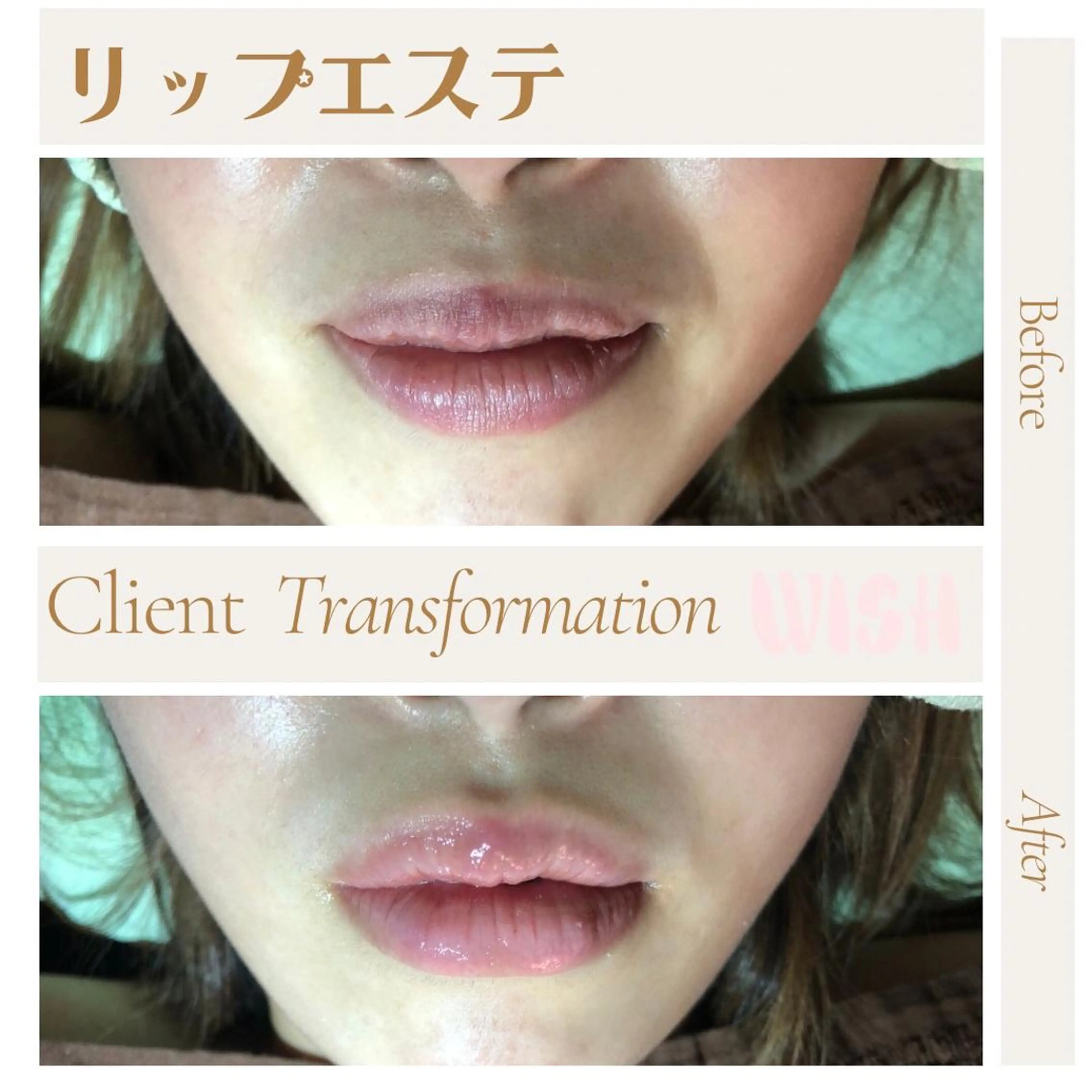 WISH 美肌脱毛のプロ！須藤のエステ・リラクイメージ