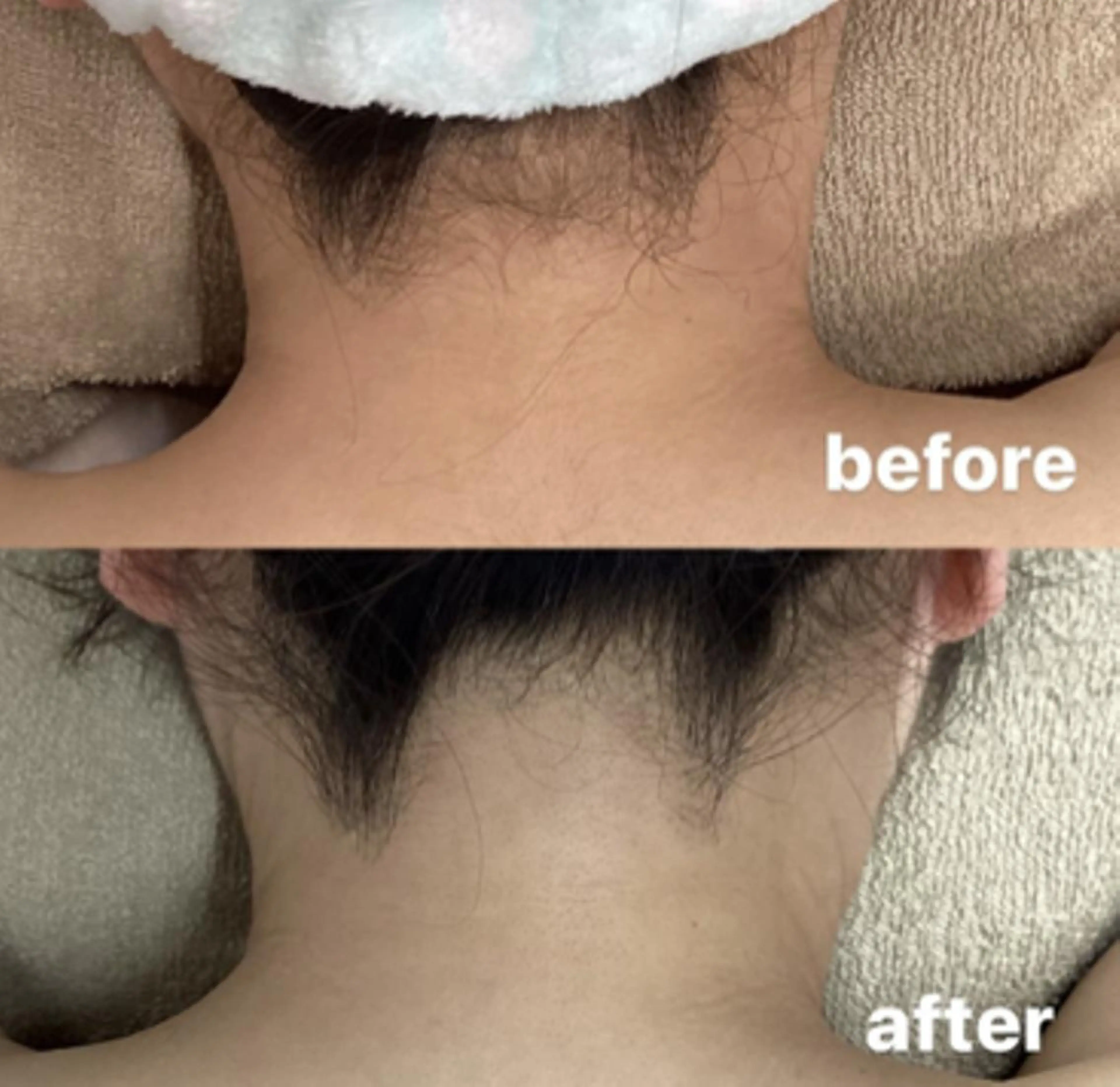 全身脱毛×マッサージ 高岳×新栄×代官町の眉毛・アイブロウイメージ