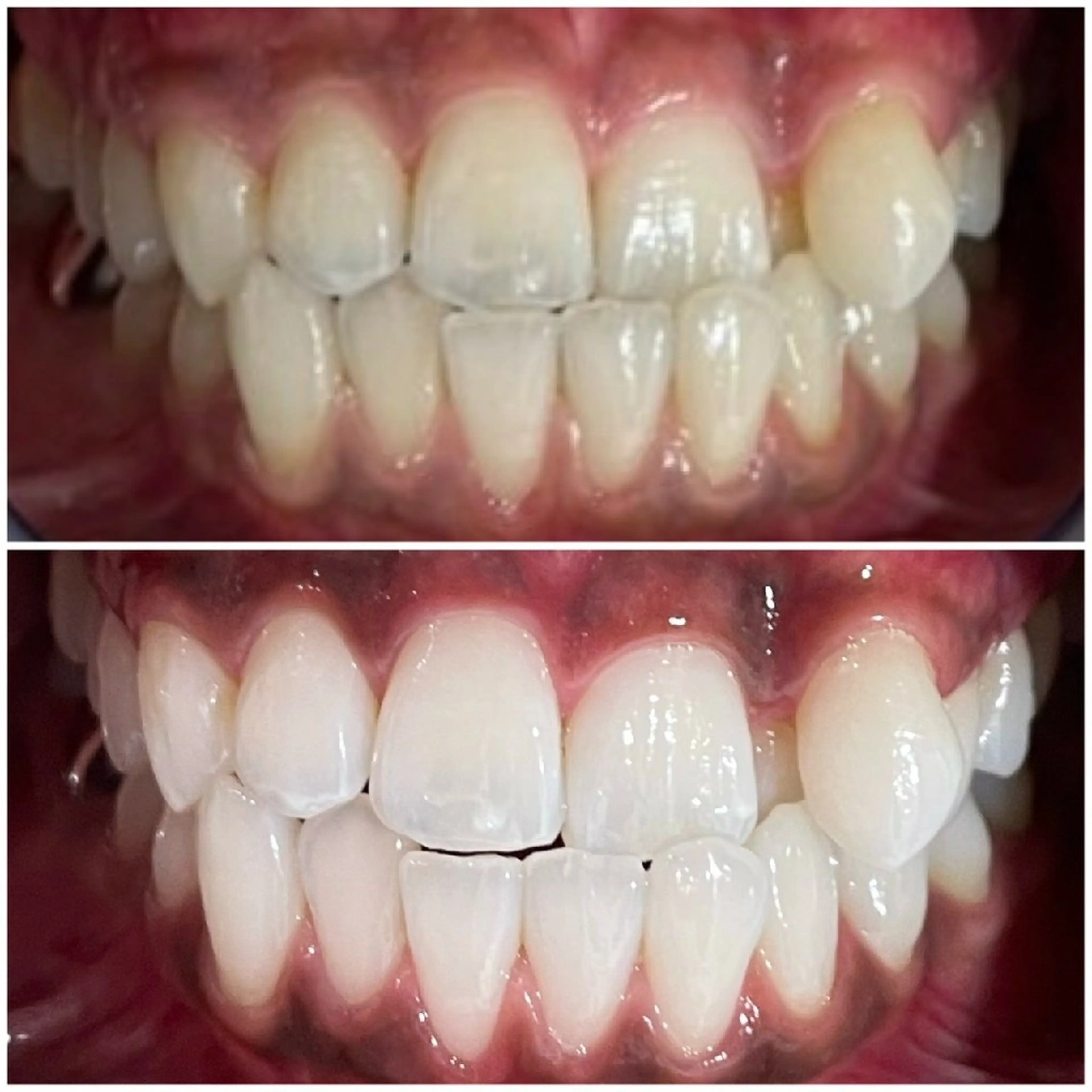 五十嵐 蓮のその他イメージ