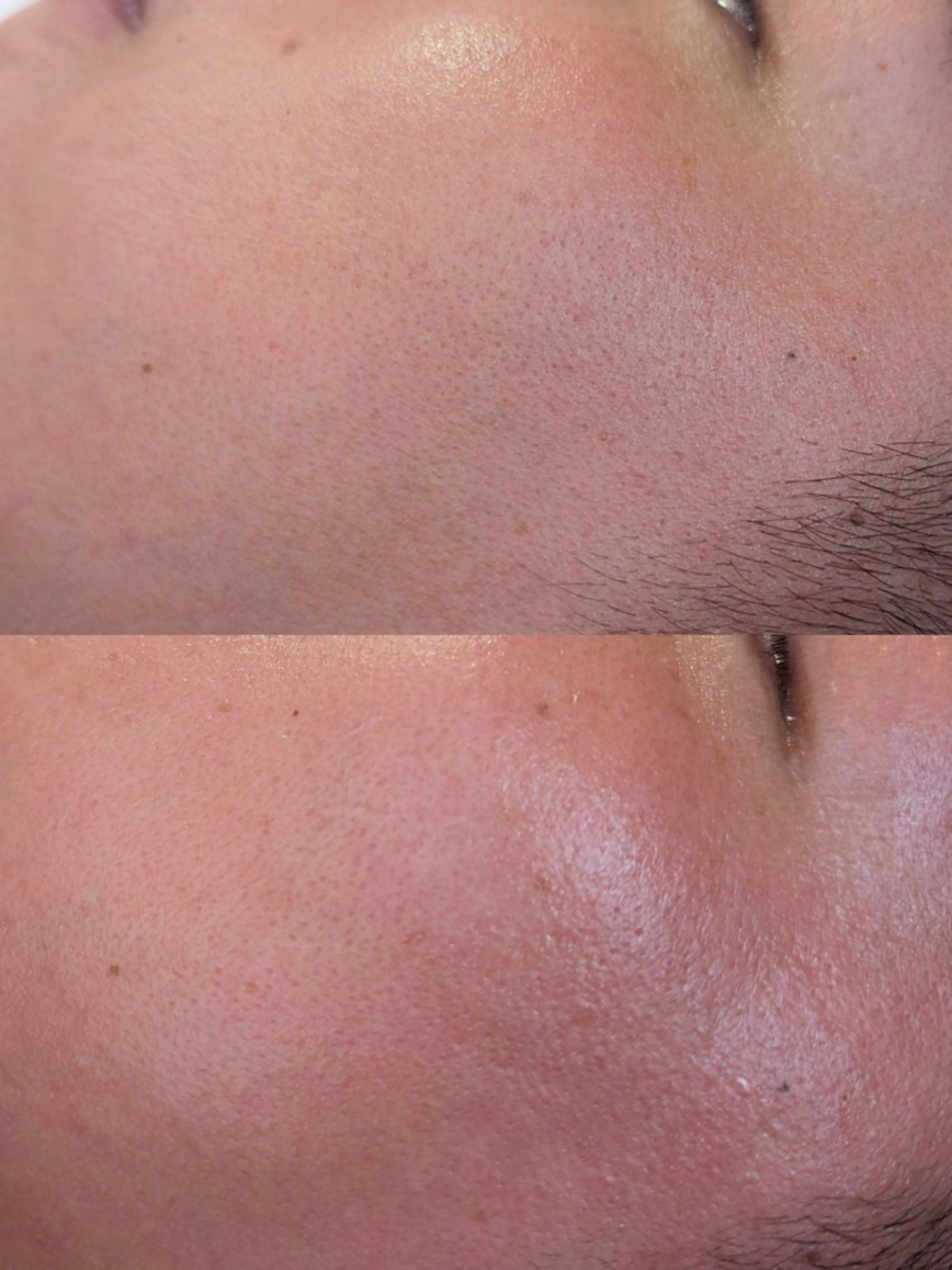 Morphome所属・【Morphome】 hinaのエステ・リラクイメージ