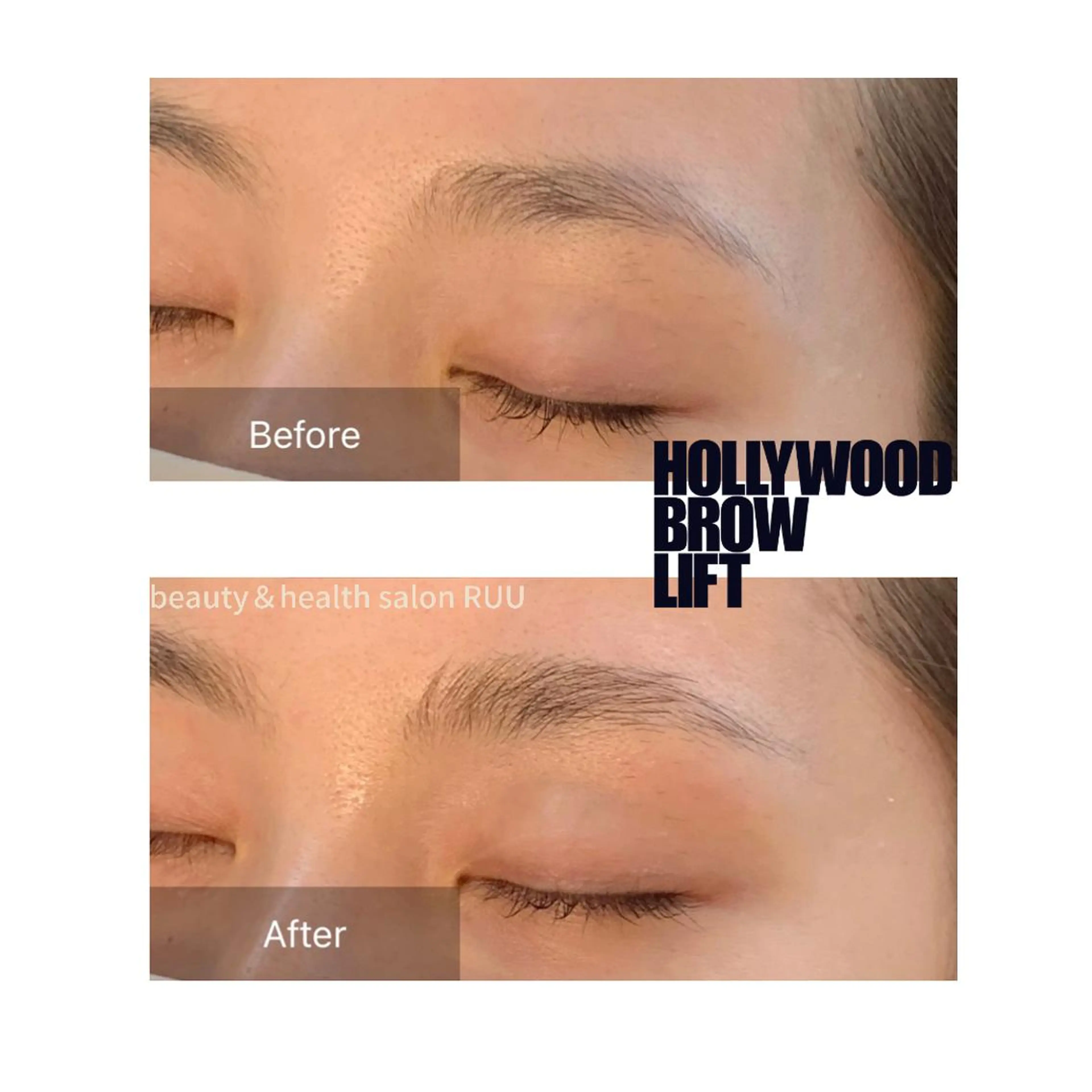 【頭痛、睡眠改善】 salon RUUのエステ・リラクイメージ