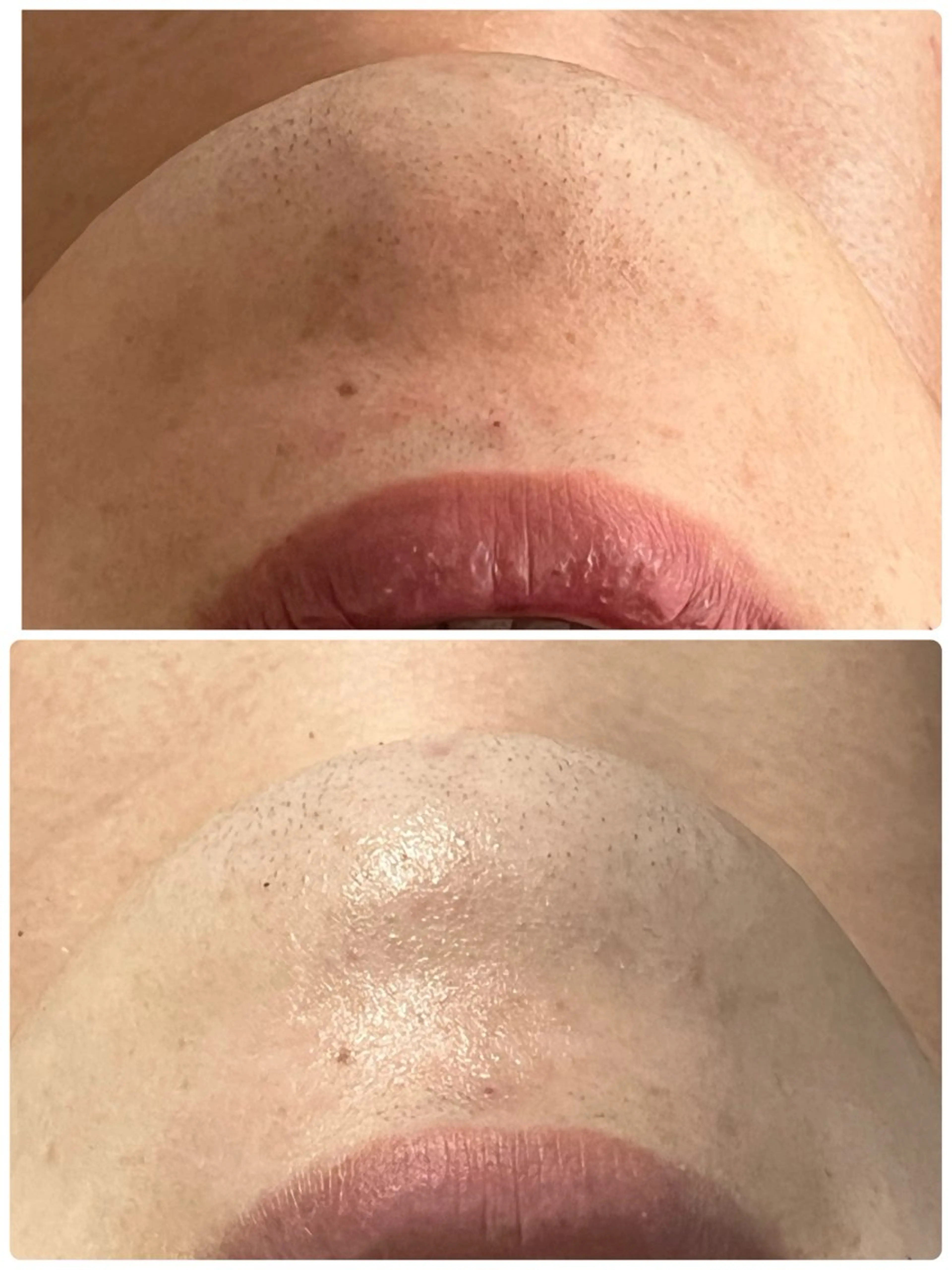 エステ ohana所属・河合 菜月のエステ・リラクイメージ