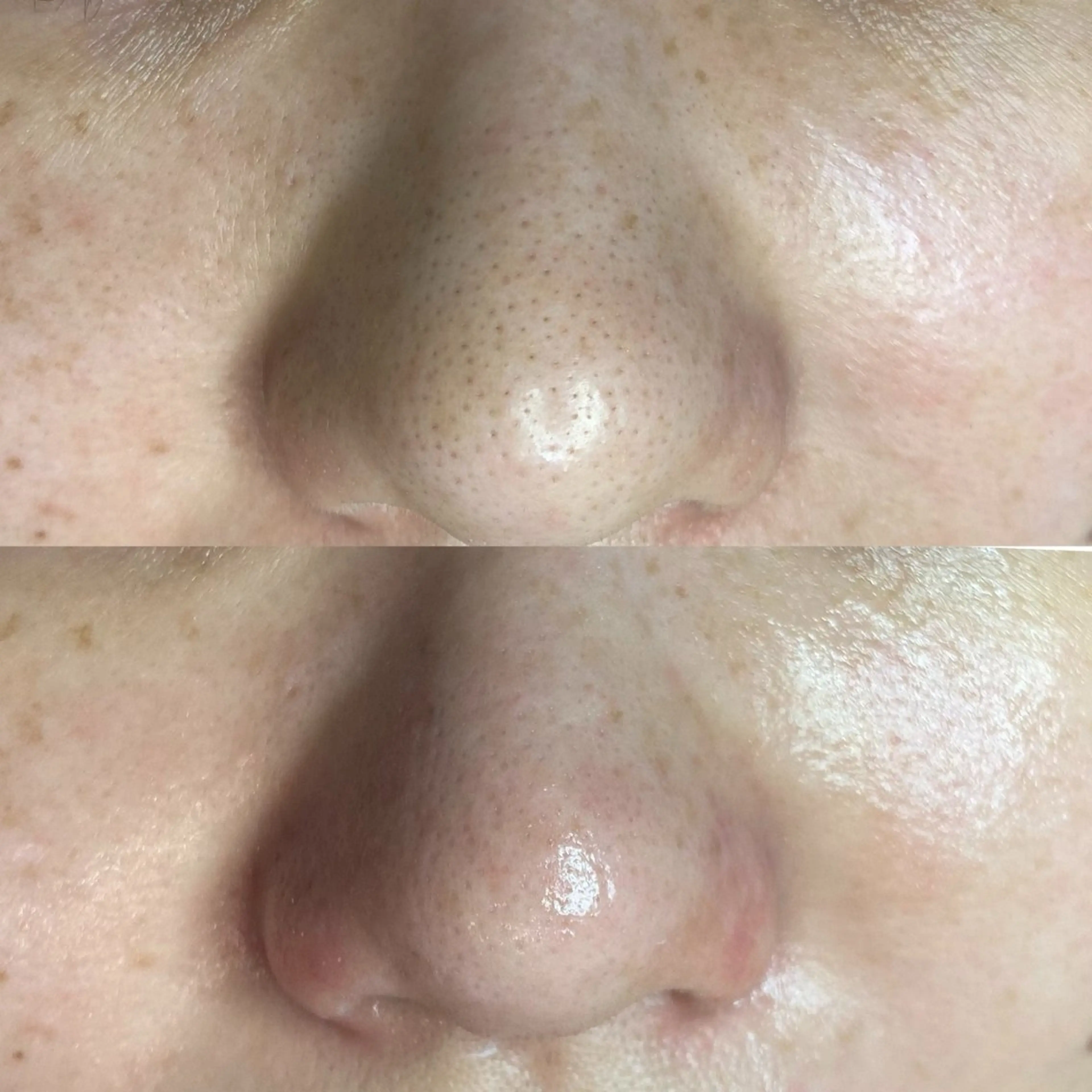 毛穴・シミ専門店MeMe多治見店所属・MeMe 多治見のエステ・リラクイメージ