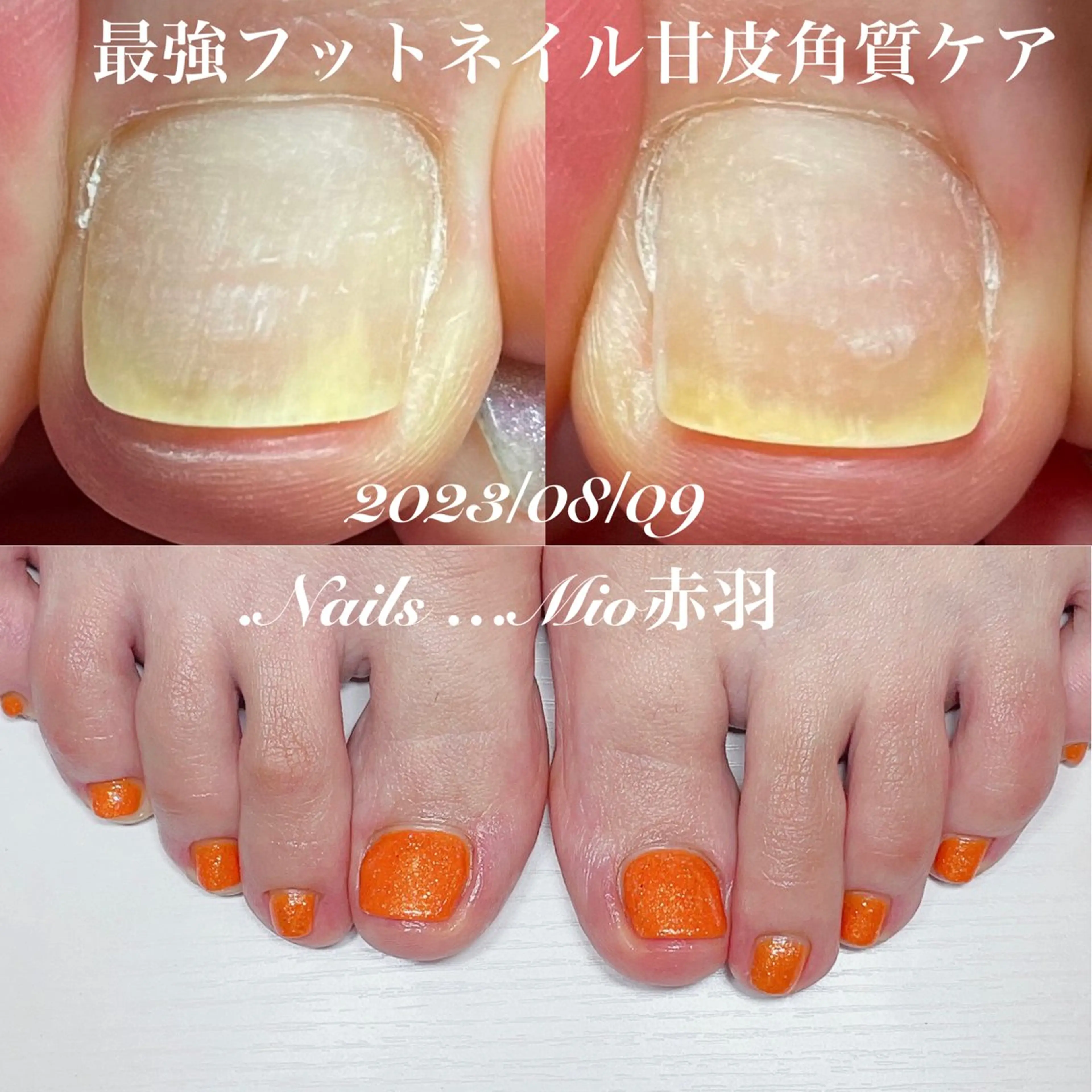 ネイル フットネイル フットネイル .Nails Mio 赤羽西ネイルサロンのネイルデザイン