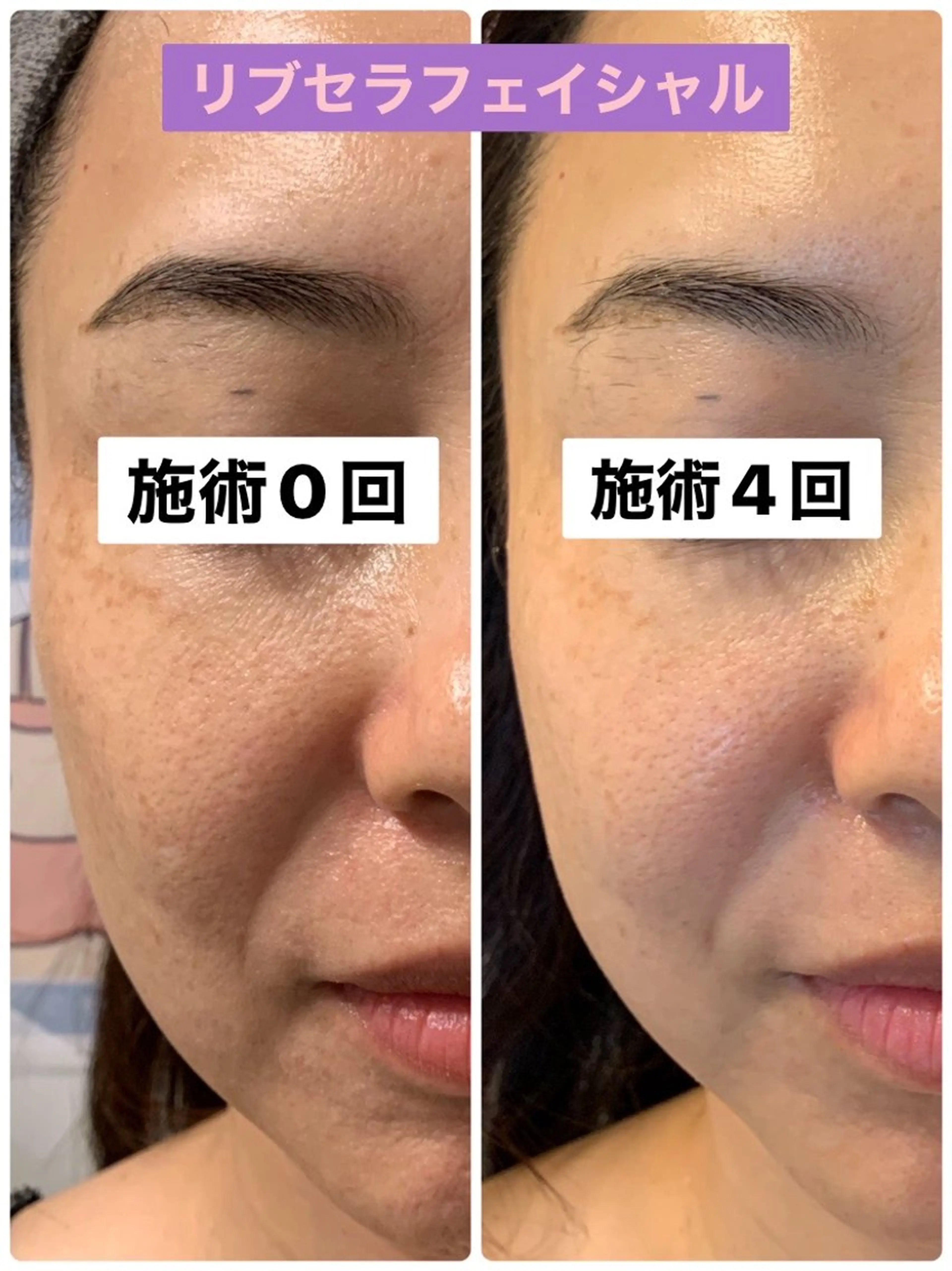 エステ Private Salon Prunelle所属・プライベートサロン プリュネルのエステ・リラクイメージ