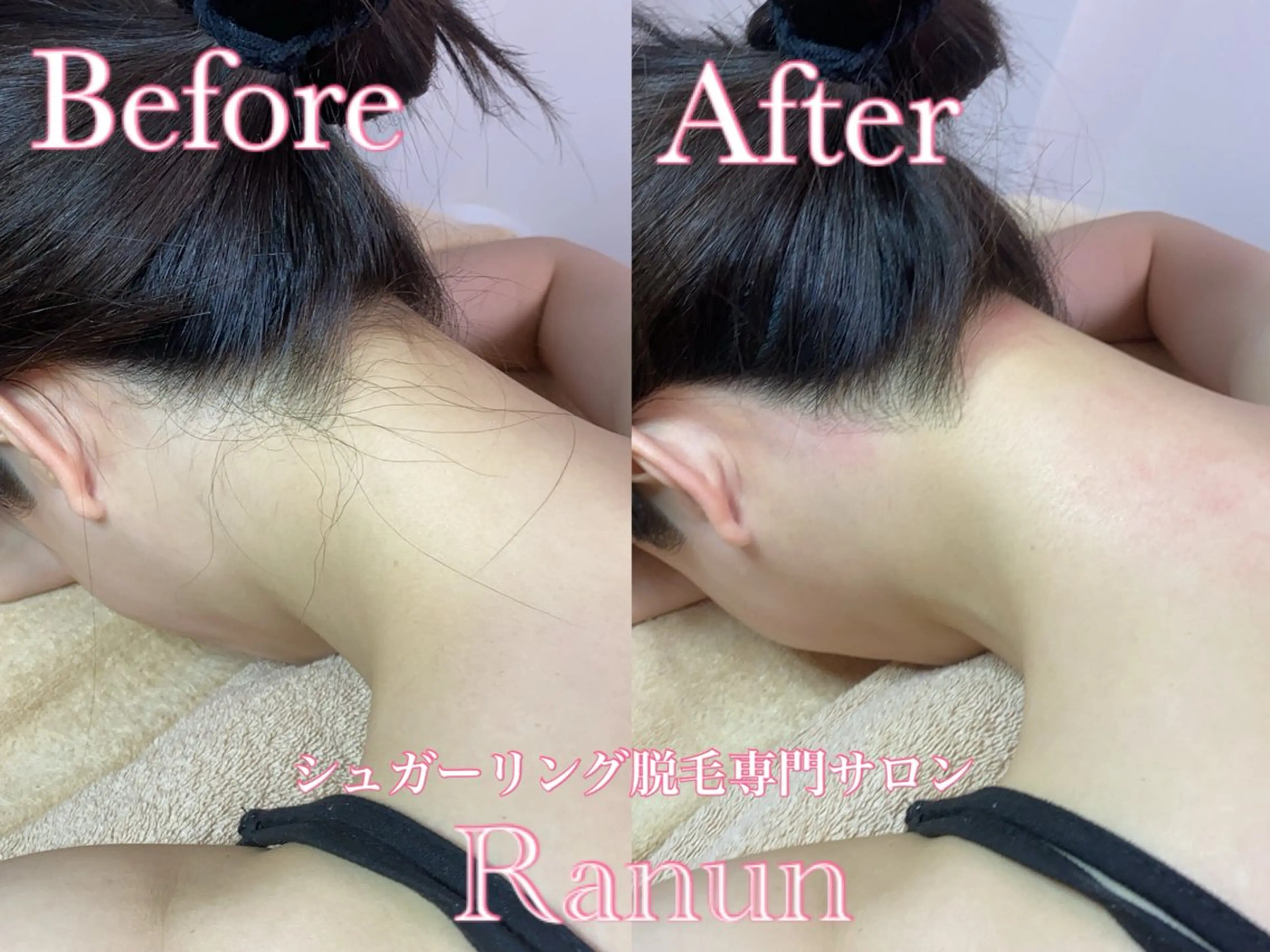 マツエク・マツパ 脱毛 シュガーリング脱毛 専門店Ranunのエステ・リラクイメージ