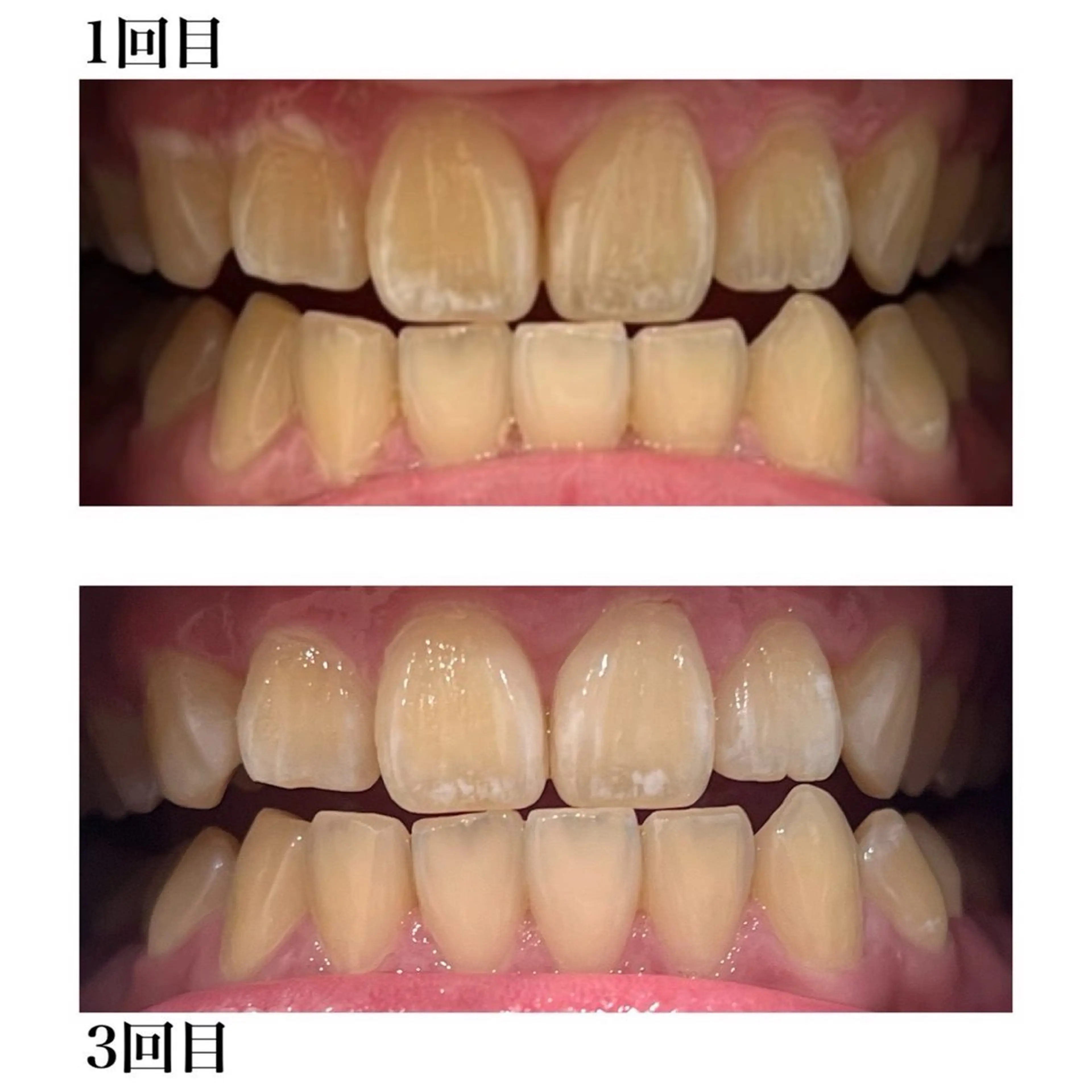 その他 ホワイトニングショップ津店所属・ホワイトニング ショップ津店のその他イメージ