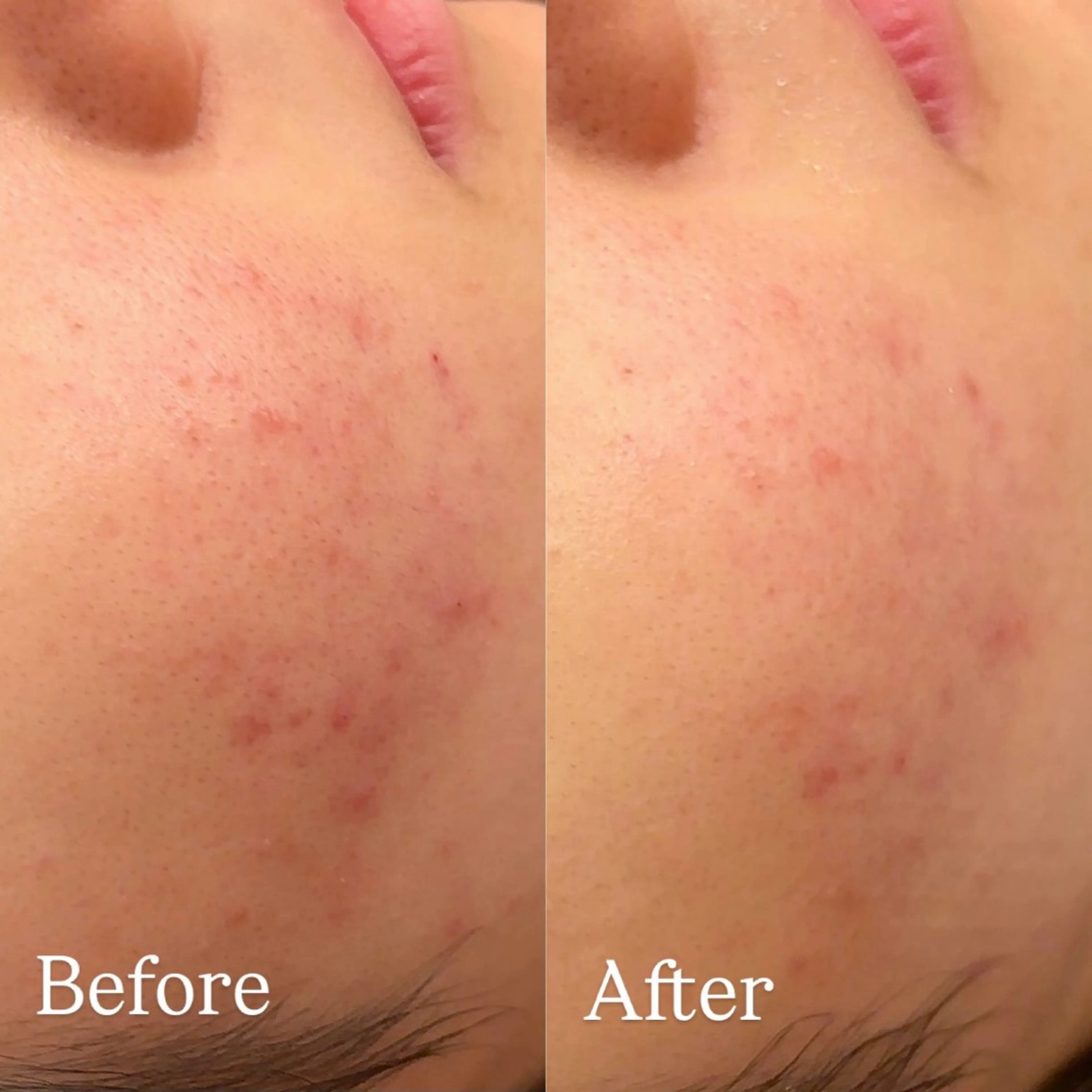 Hari Lounge恵比寿所属・chika🦋 ハリラウンジ恵比寿のエステ・リラクイメージ