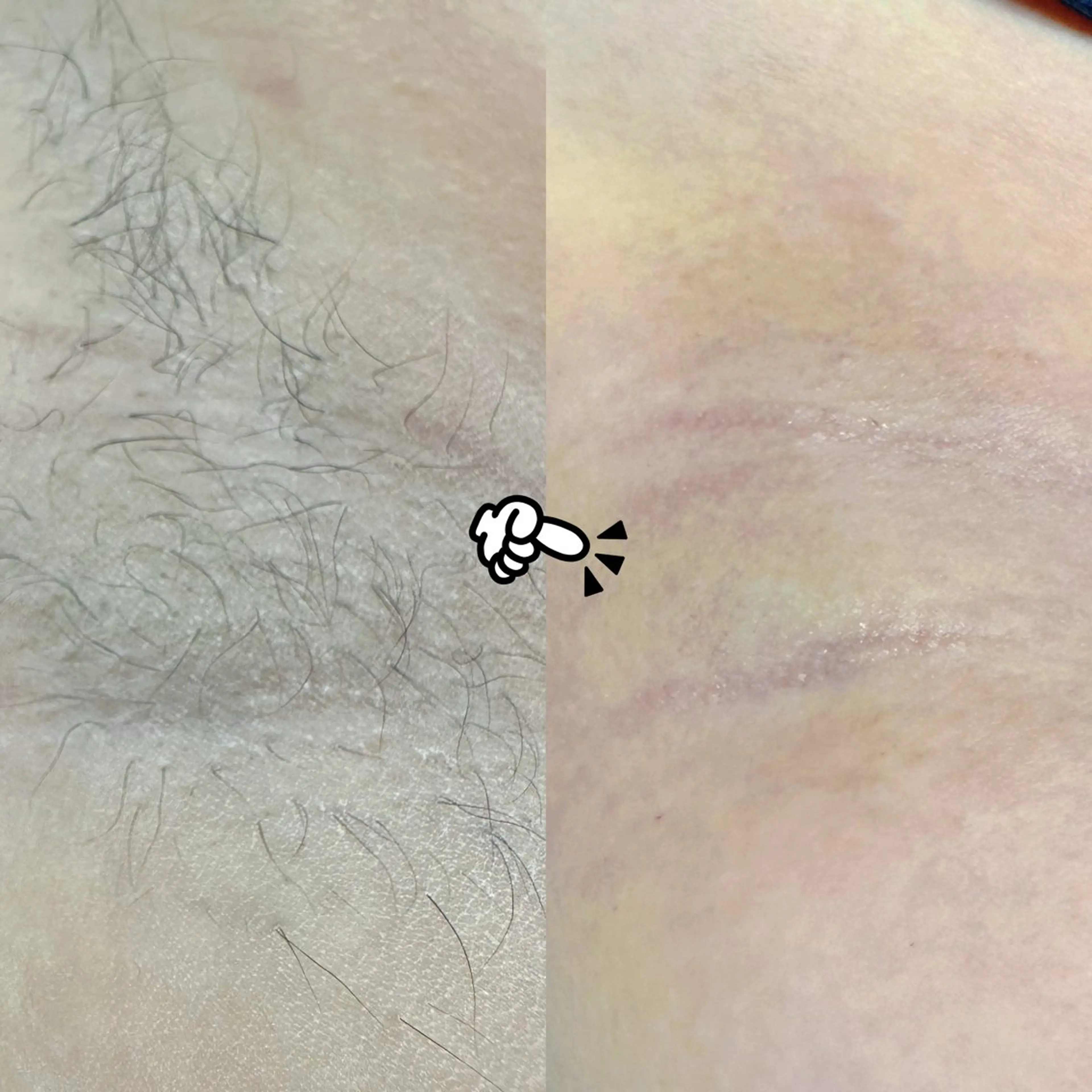 Hit. シュガーリング豊橋のエステ・リラクイメージ