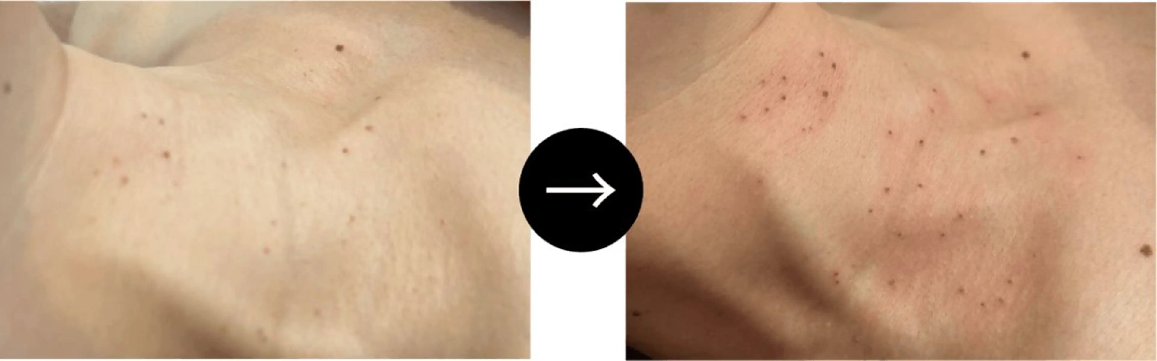 ハーブピーリング専門 muro.のエステ・リラクイメージ