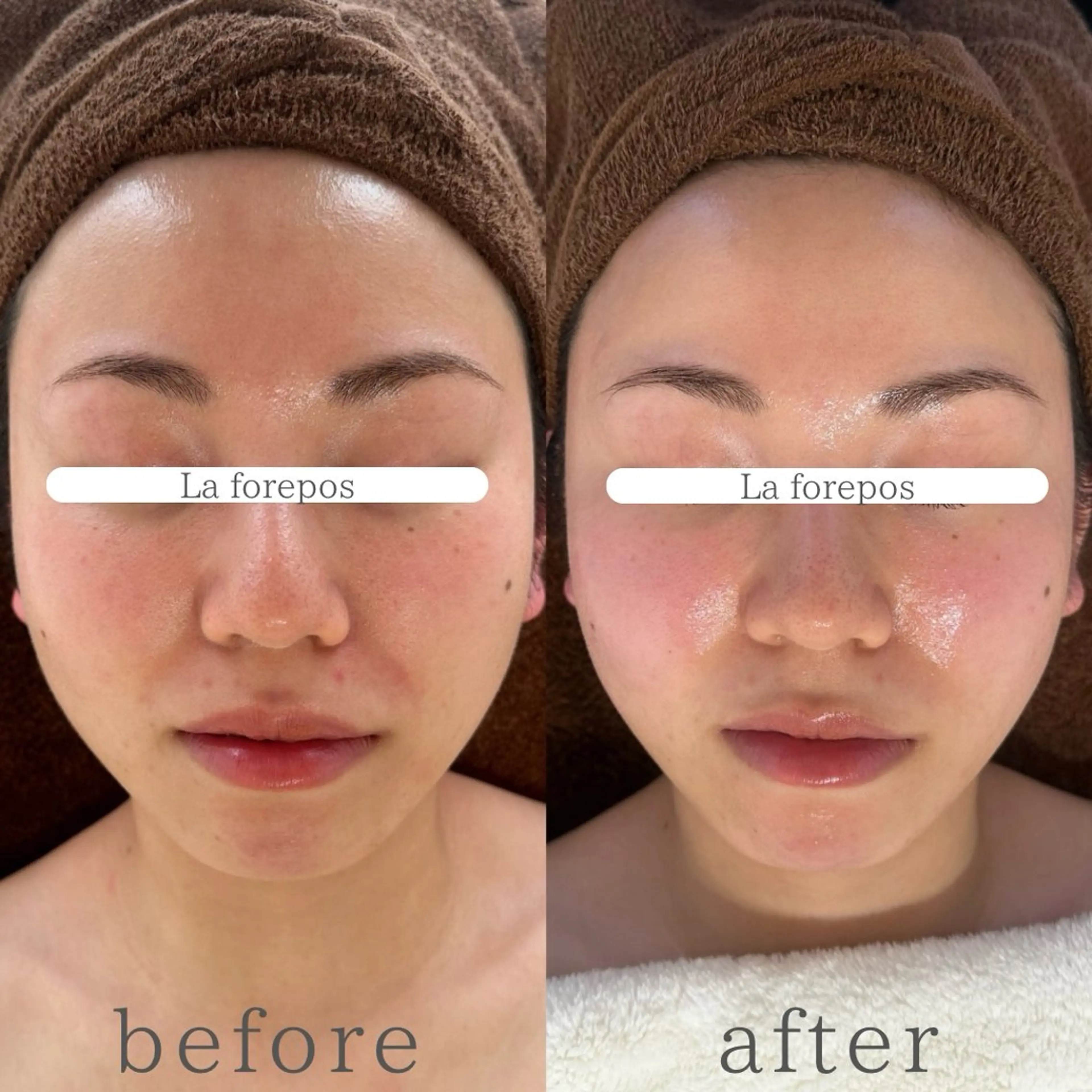 La forepos 恵比寿所属・La forepos フェイシャルエステのエステ・リラクイメージ