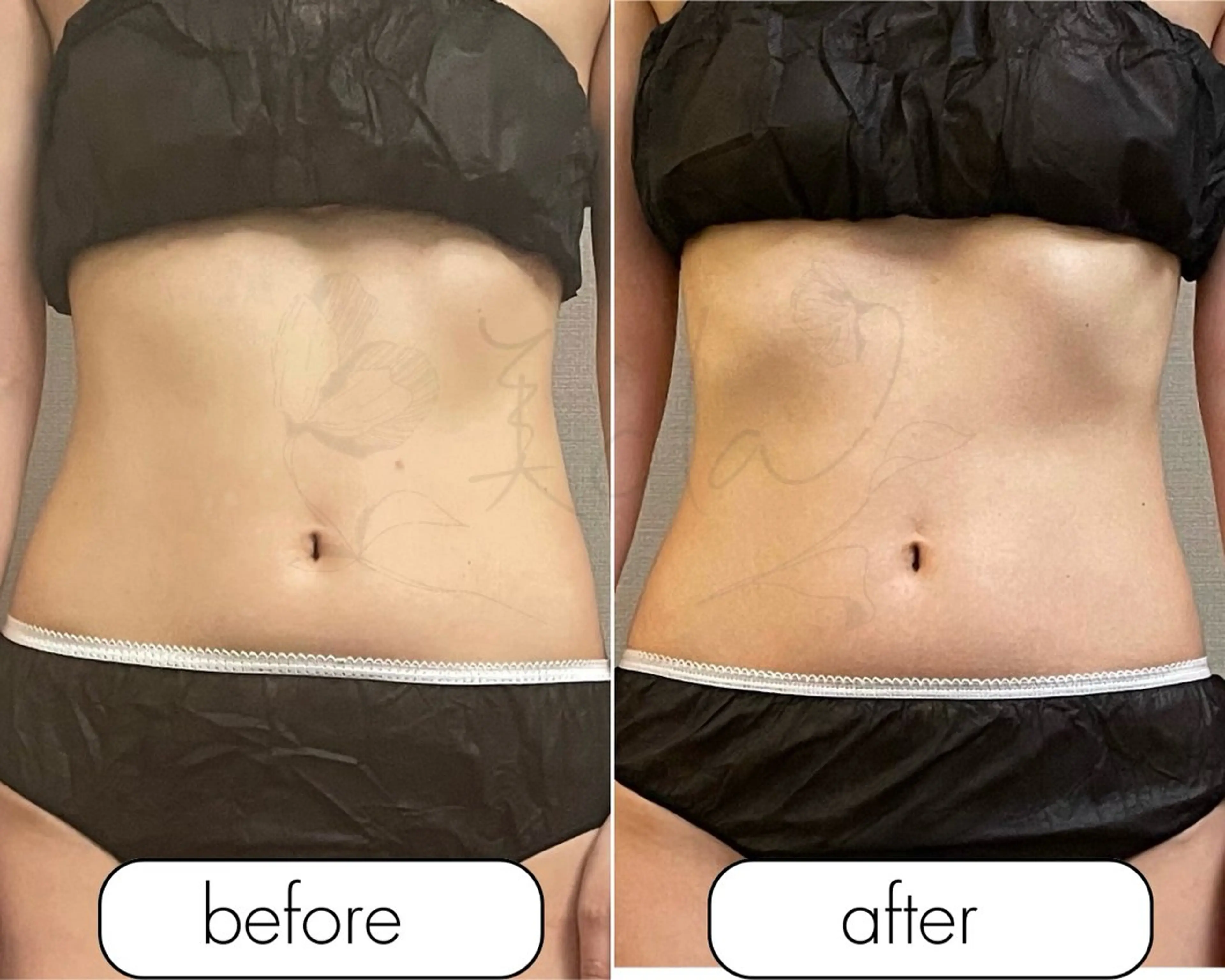 エステ リラク 美ola ビオラのエステ・リラクイメージ