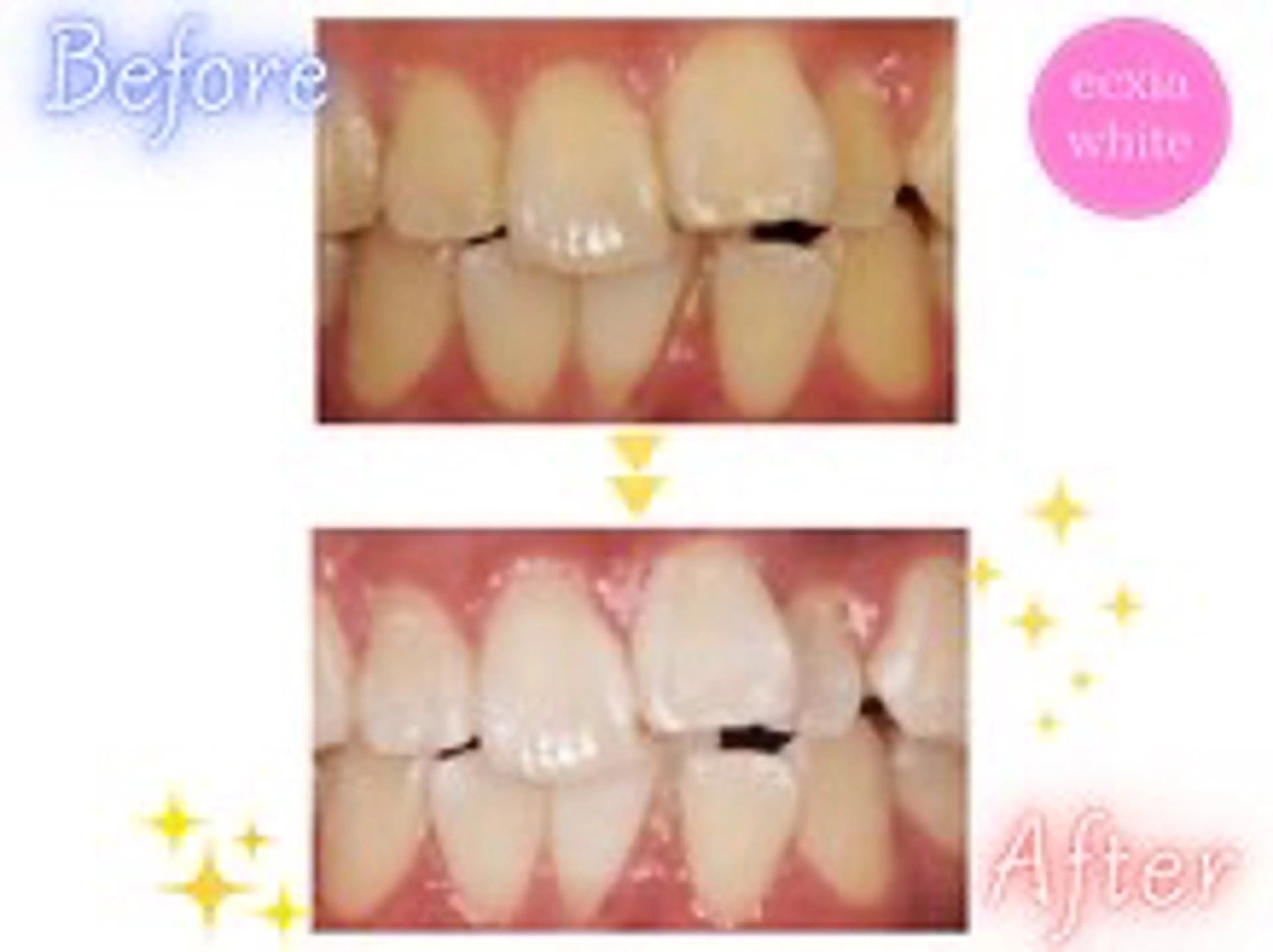 ecxia white 高田馬場所属・セルフホワイトニング エクシア 高田馬場のその他イメージ