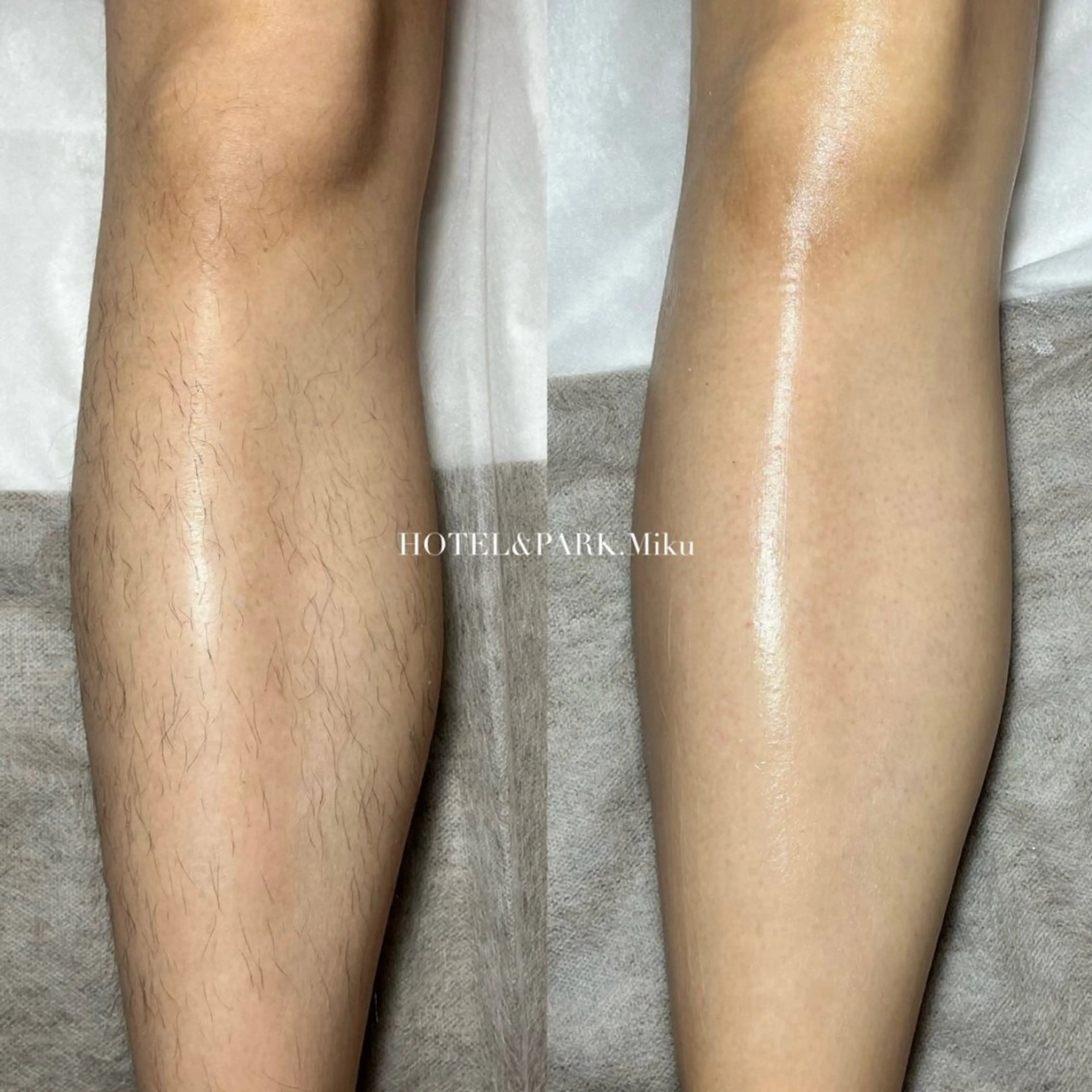 HOTEL&PARK . ワックス脱毛のエステ・リラクイメージ