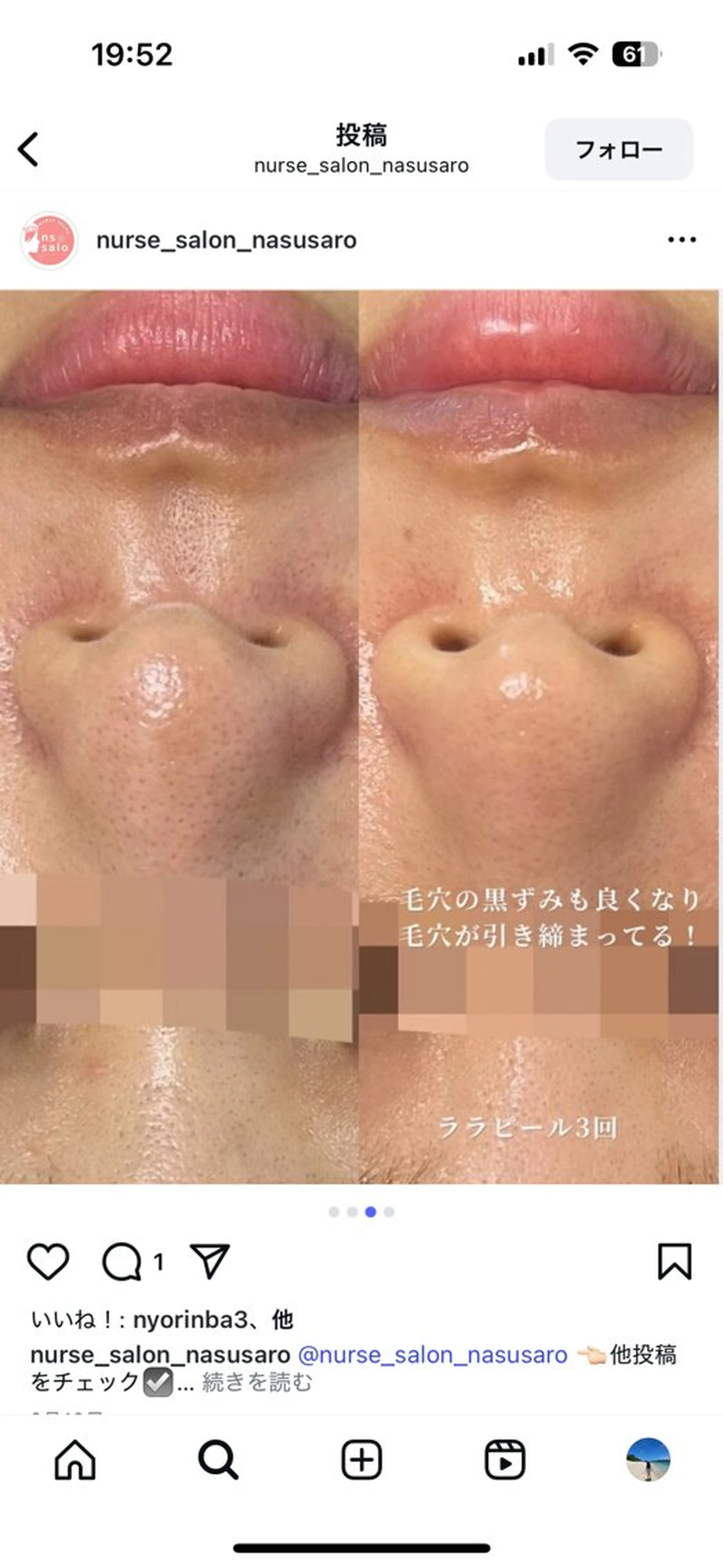 エステ 看護師が施術する美容 ナスサロ/川口のエステ・リラクイメージ