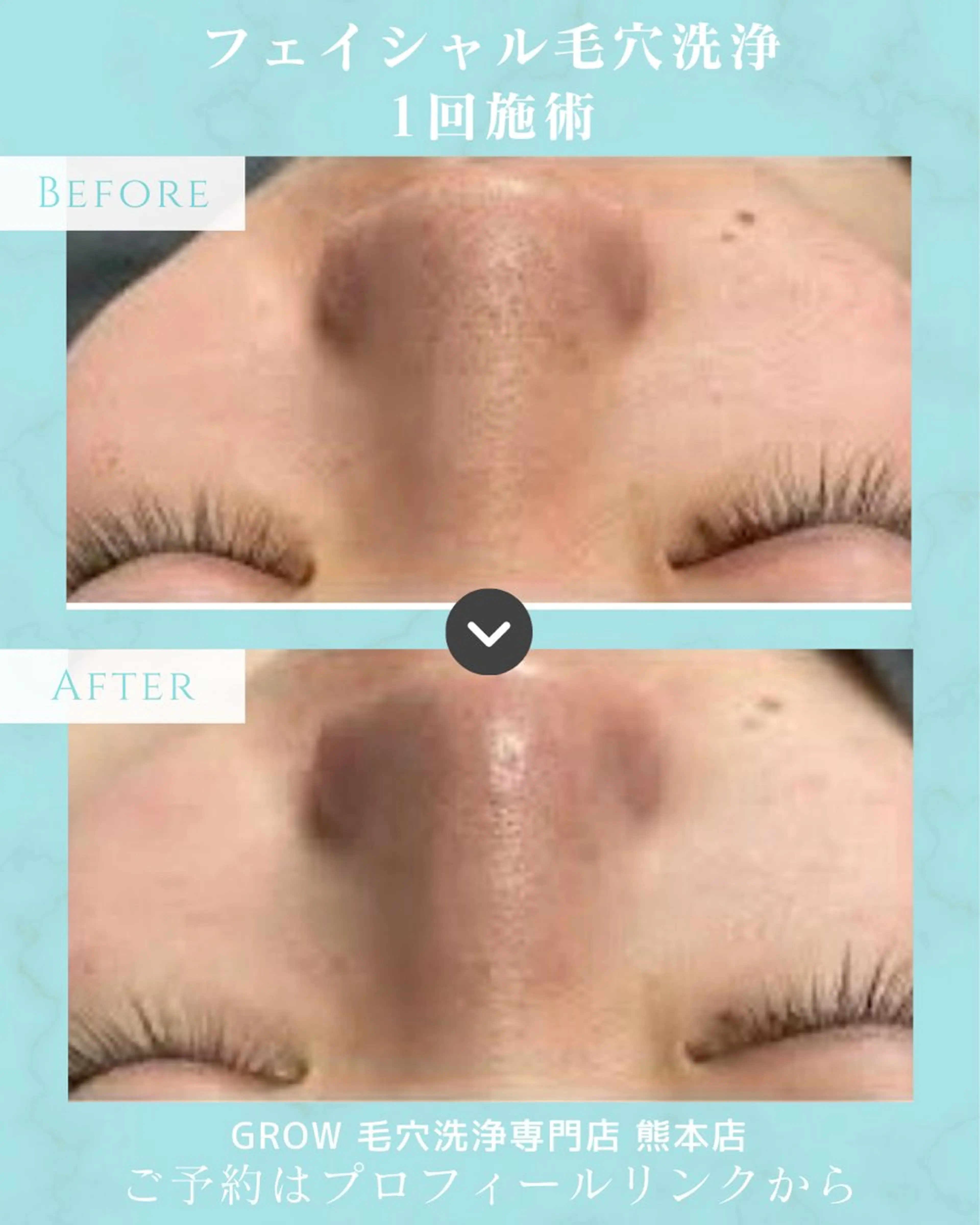 韓国式フェイシャル エステGROW熊本店のエステ・リラクイメージ