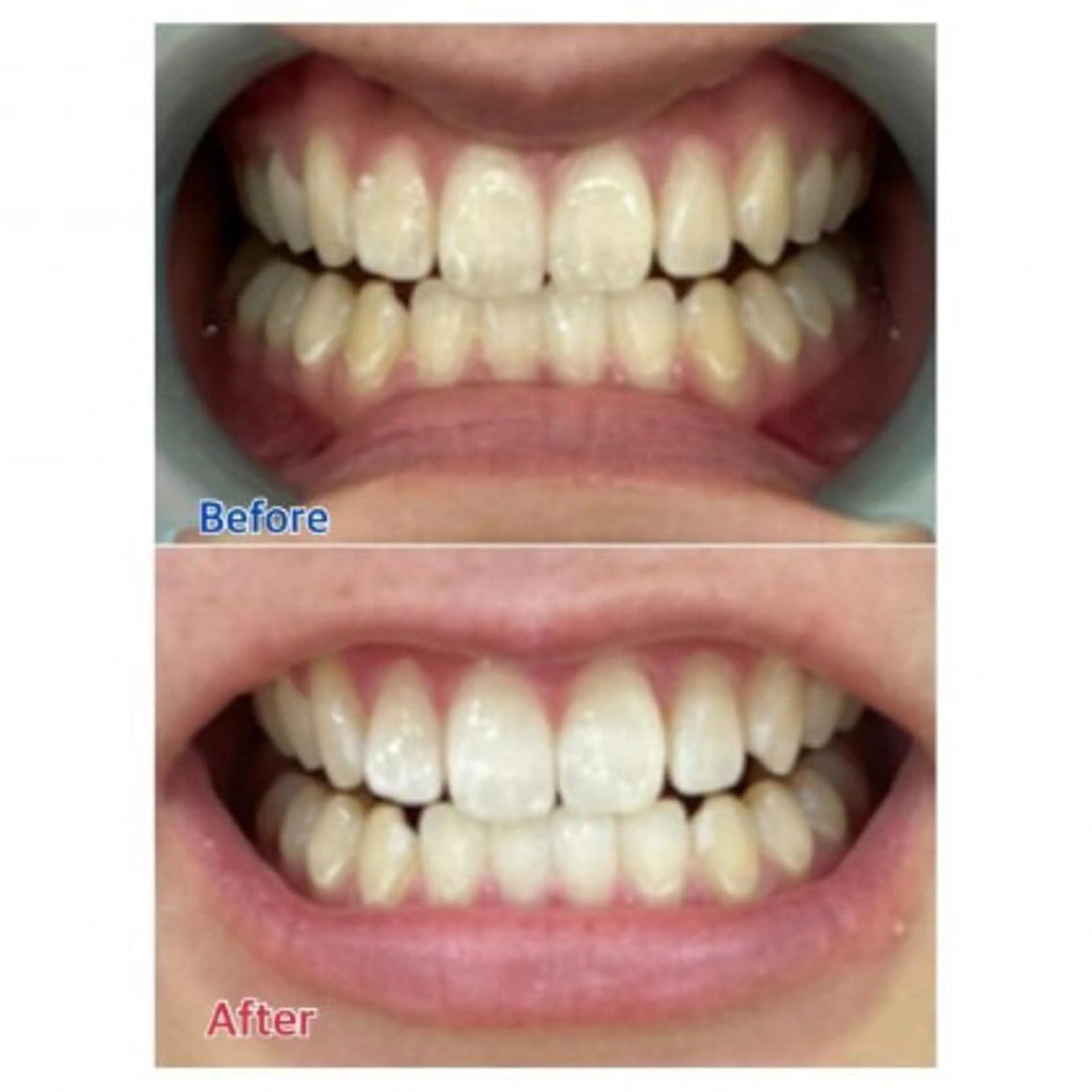 M渋谷店所属・Ｍ渋谷 ホワイトニングのエステ・リラクイメージ