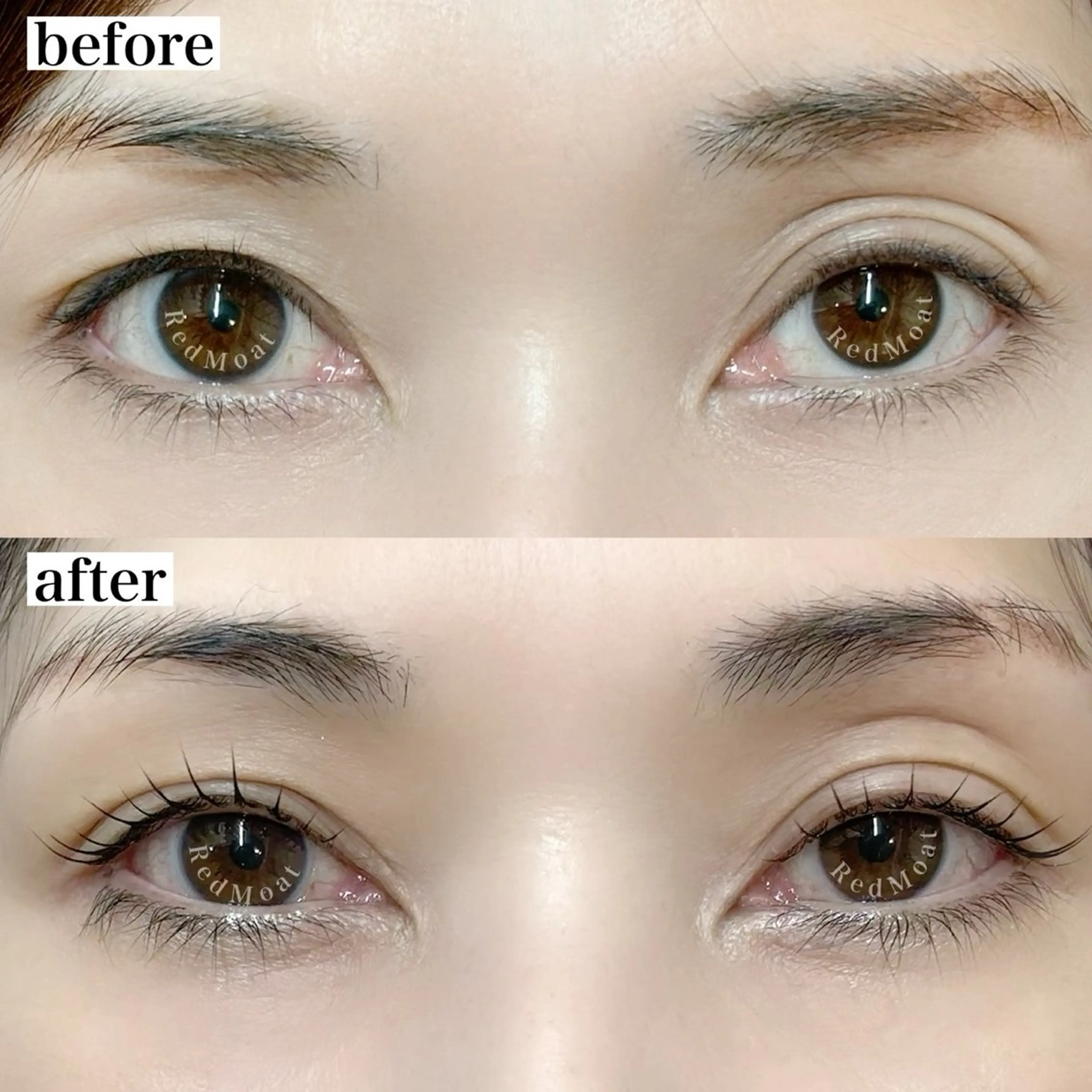 ダブルアイリフト&パリジェンヌの写真