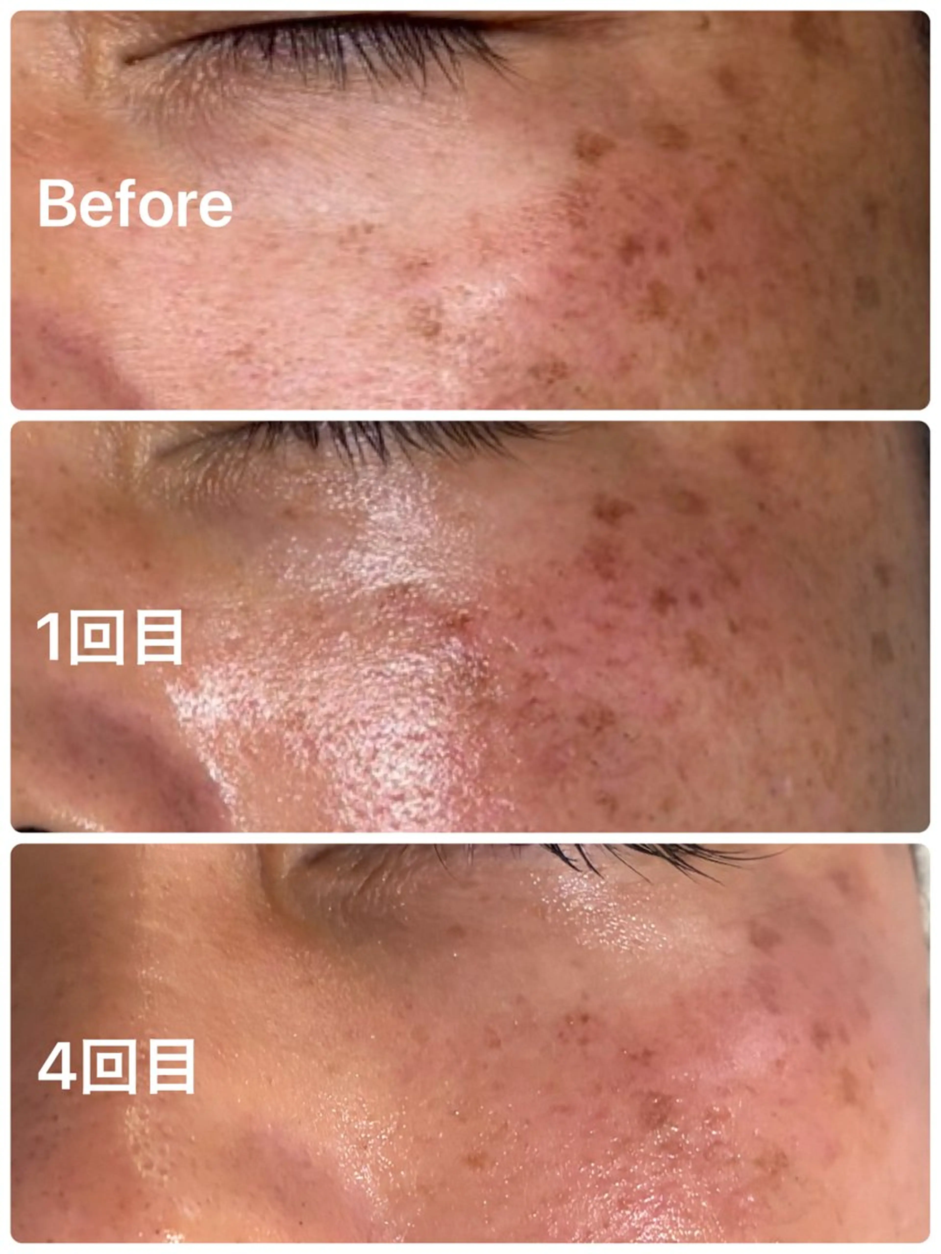 facial salon D 吉沢のエステ・リラクイメージ