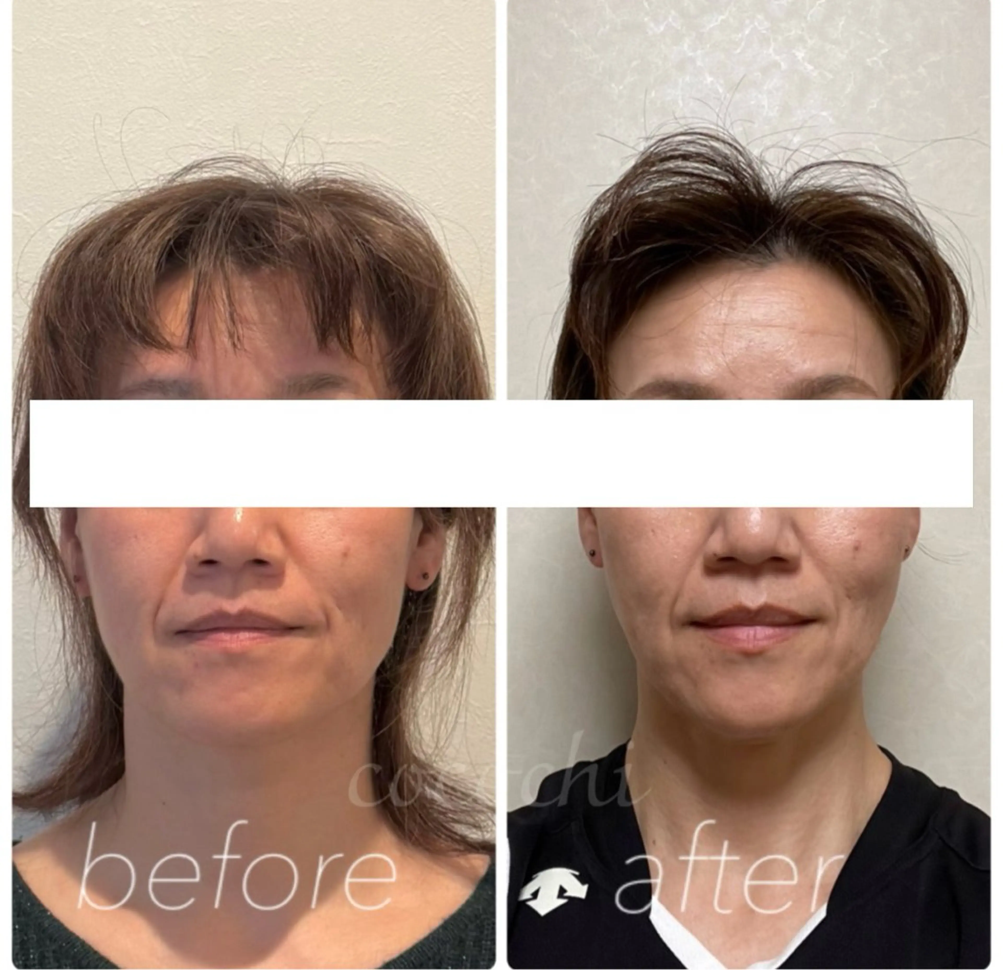 エステ リラク 小顔と ヘッドスパのお店のエステ・リラクイメージ