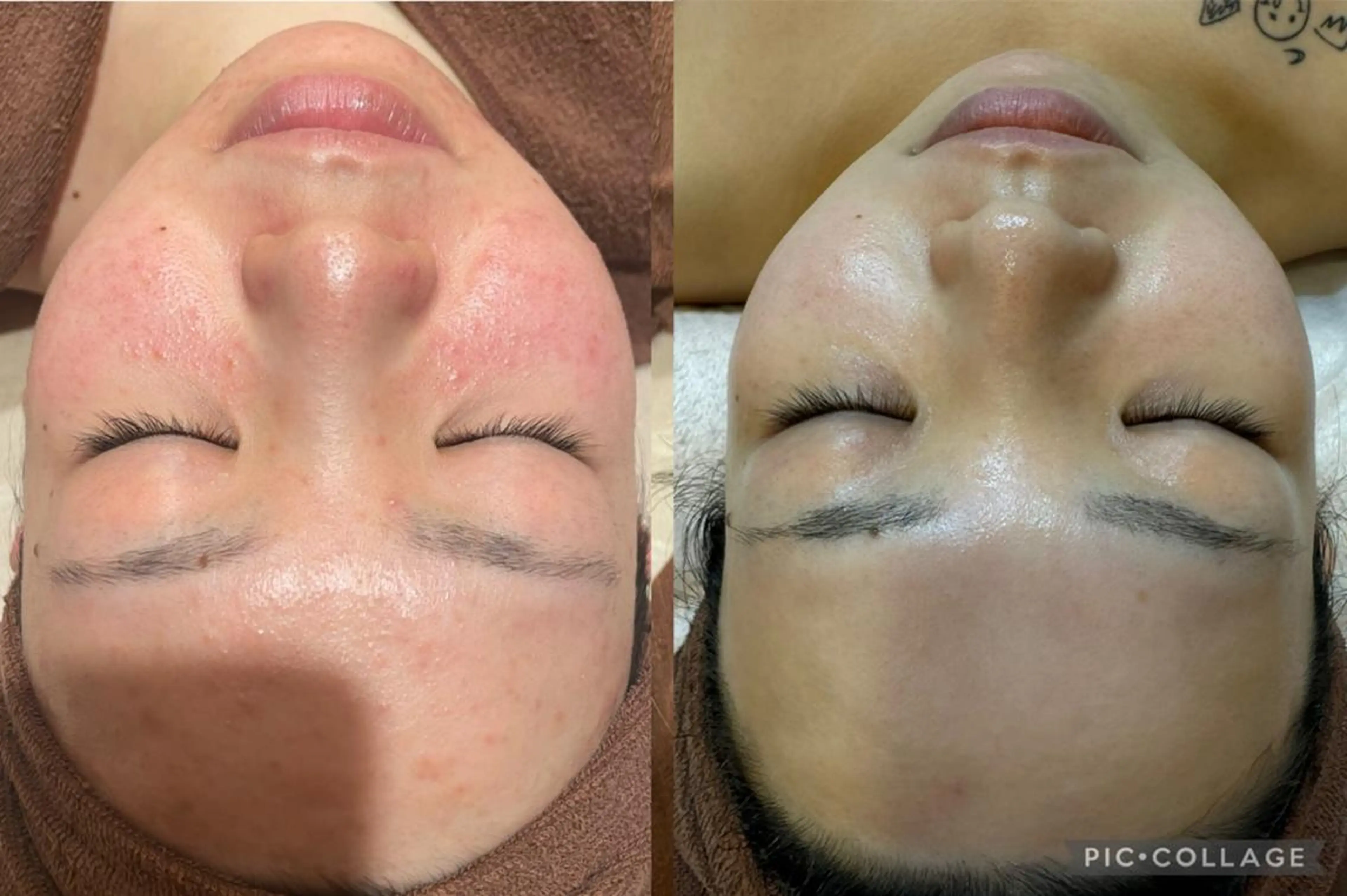 🎀美肌ケアサロン 🎀レイビス銀座店のエステ・リラクイメージ